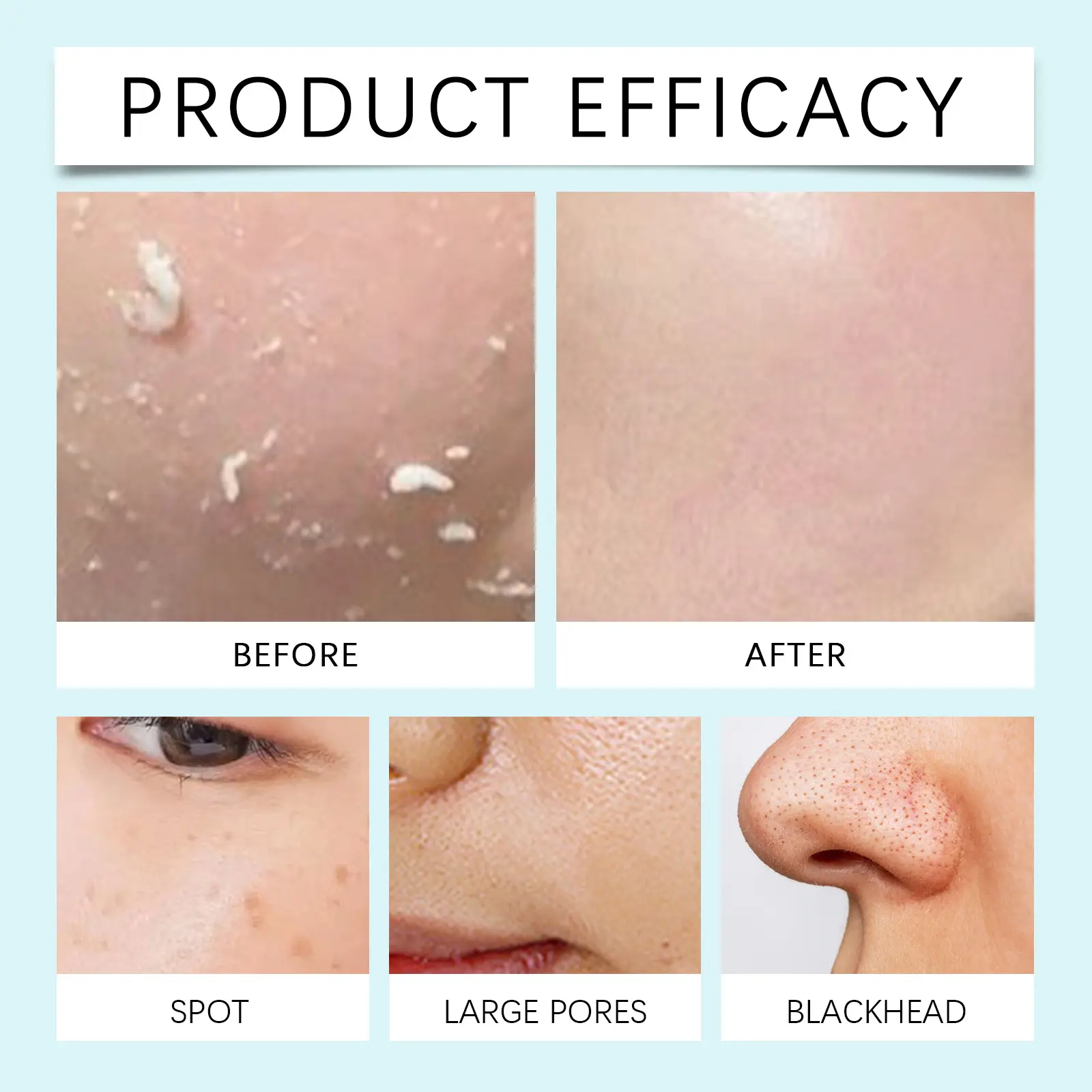 Gentle Facial Exfoliator for Smooth Skin - West&Month 9 facial exfoliating essence clean pores smooth West Month 166 3188