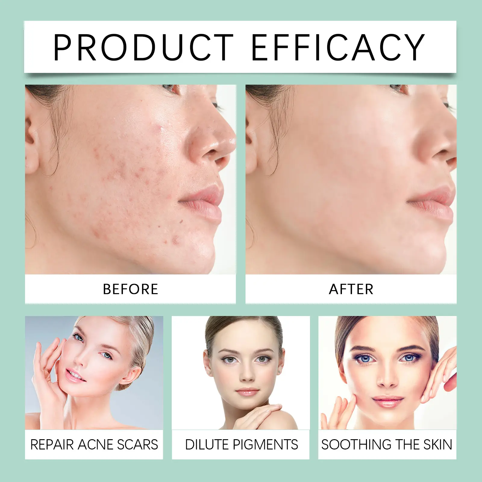 Facial Toner for Acne-Prone Skin with Green Tea & Hyaluronic Acid - West&Month 8 facial toner mild lighten acne nourish West Month 219 3860