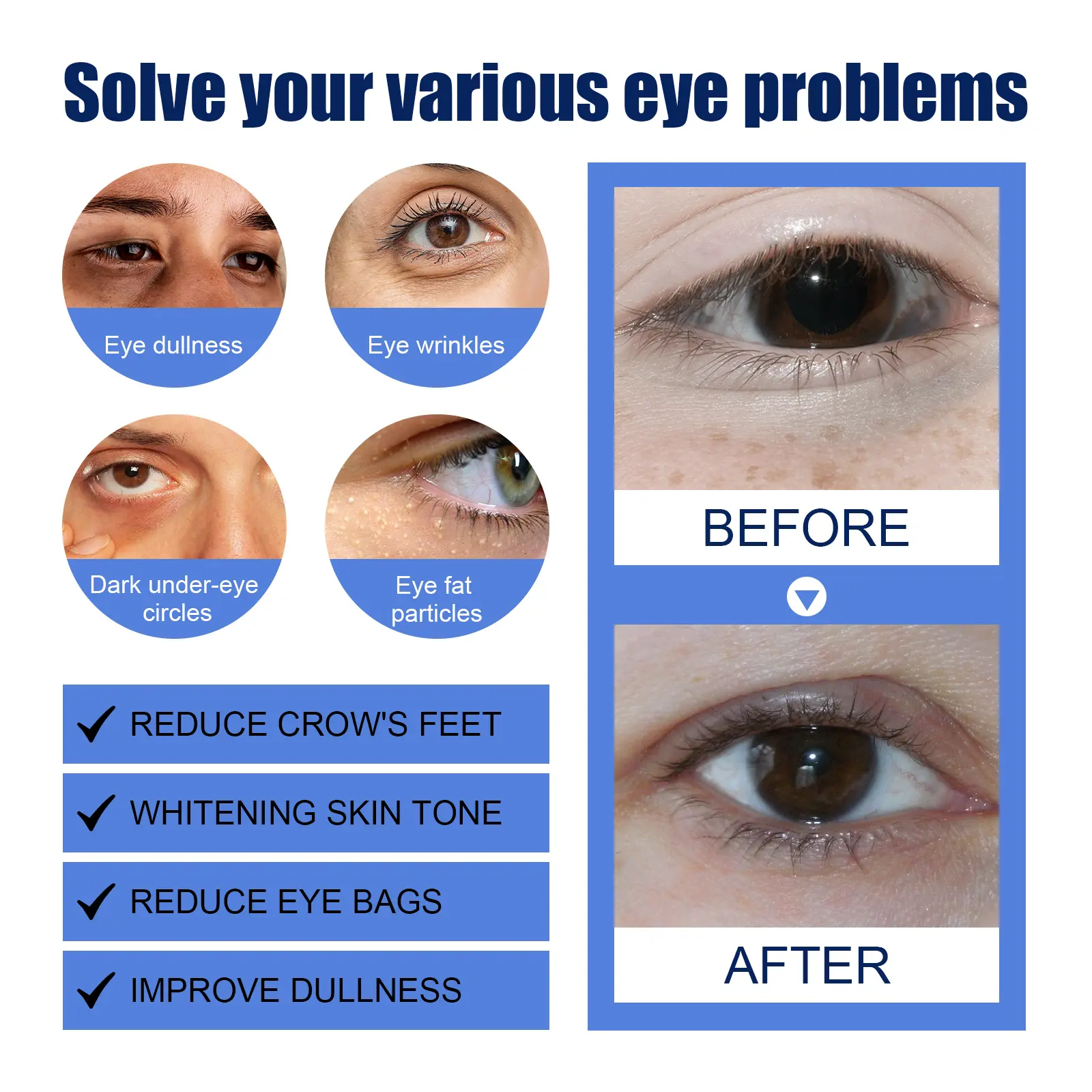 Firming Eye Cream for Dark Circles & Fine Lines - West&Month 9 firming eye cream lighten lines dark circles West Month 330 5274