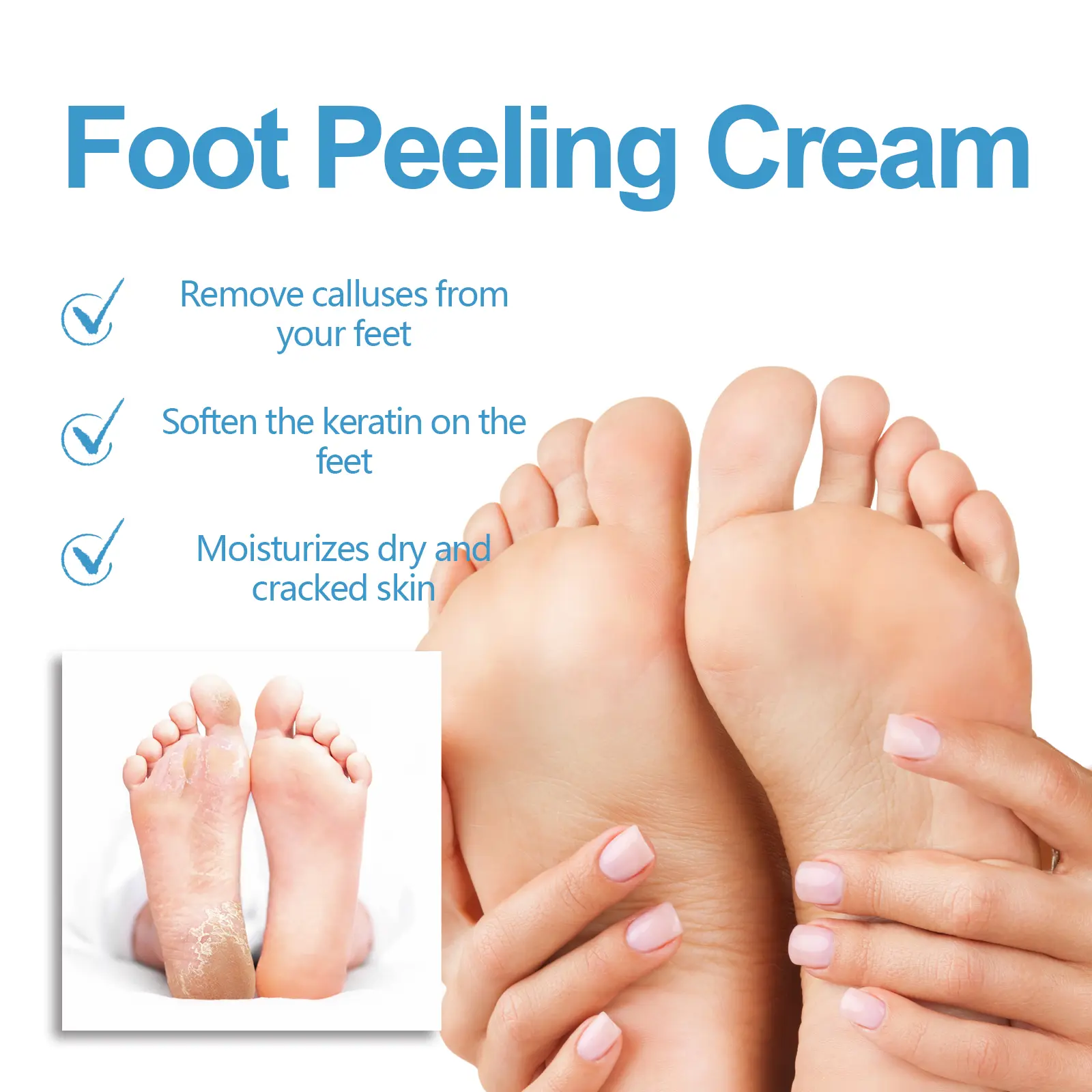 Foot Care Cream for Calluses and Cracked Heels - West&Month 6 foot care cream repair calluses moisturize heel West Month 602 8869