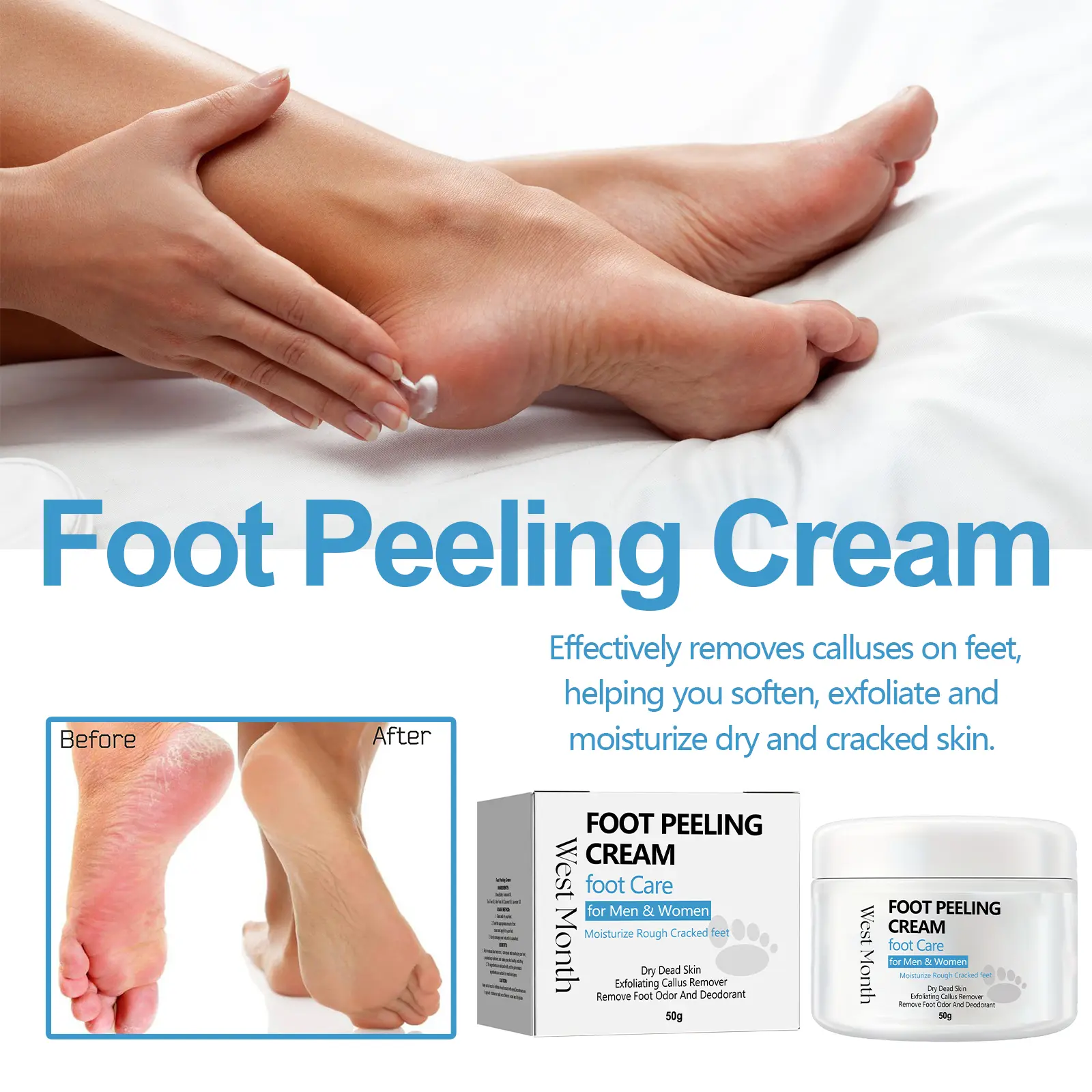 Foot Care Cream for Calluses and Cracked Heels - West&Month 8 foot care cream repair calluses moisturize heel West Month 602 8876