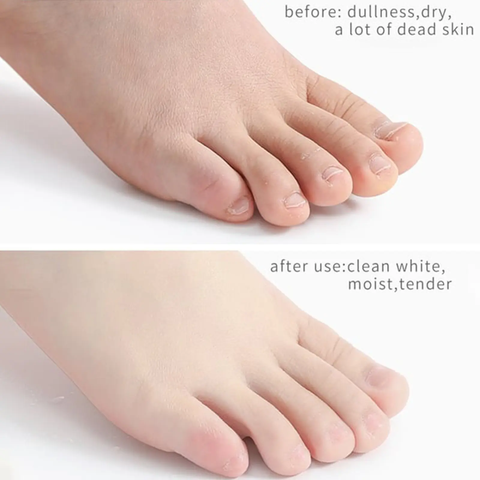 Foot Care Spray for Dry Cracked Feet & Odor Control - West&Month 9 foot care spray anti crack clean moisturize West Month 380 5969
