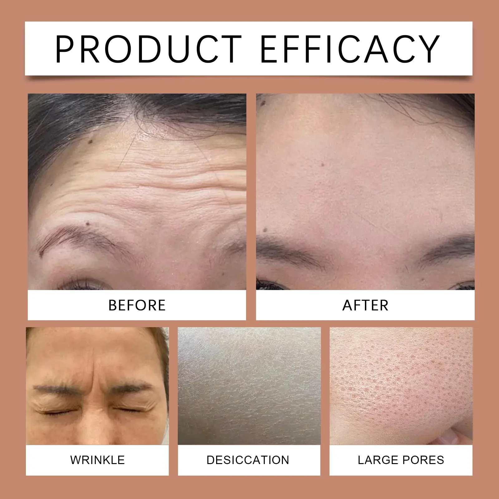 Hydrating Forehead Patch for Wrinkle Reduction & Skin Firming - West&Month 12 forehead patch hydrate tighten nourish radiant West Month 645 9347