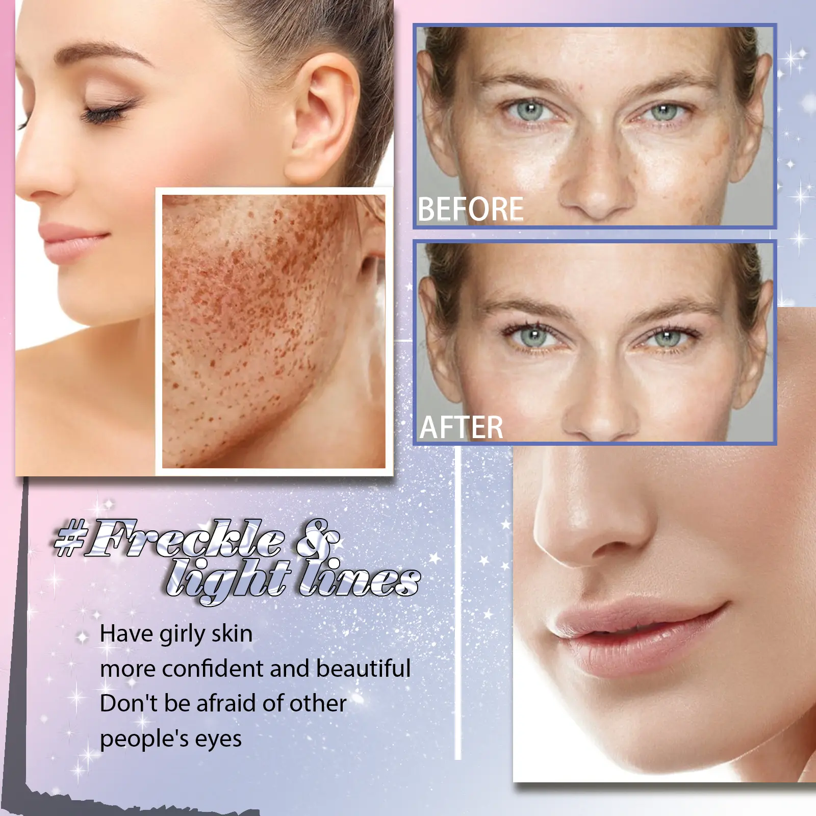 Anti-Aging Skin Essence for Wrinkles & Freckles - West&Month 5 freckle removing essence anti aging firming West Month 140 2865