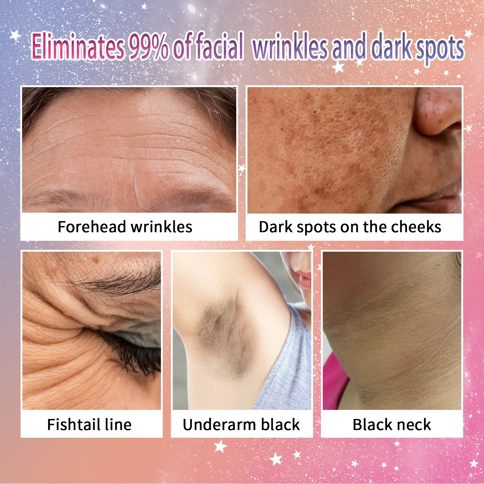Anti-Aging Skin Essence for Wrinkles & Freckles - West&Month 6 freckle removing essence anti aging firming West Month 140 2866