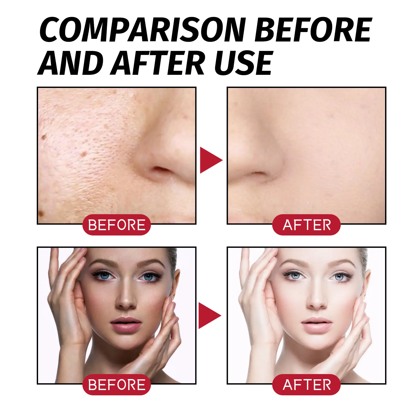AHA Fruit Acid Essence for Pore Minimizing & Smoothing - West&Month 9 fruit acid essence smooth firm narrow pores West Month 341 5424