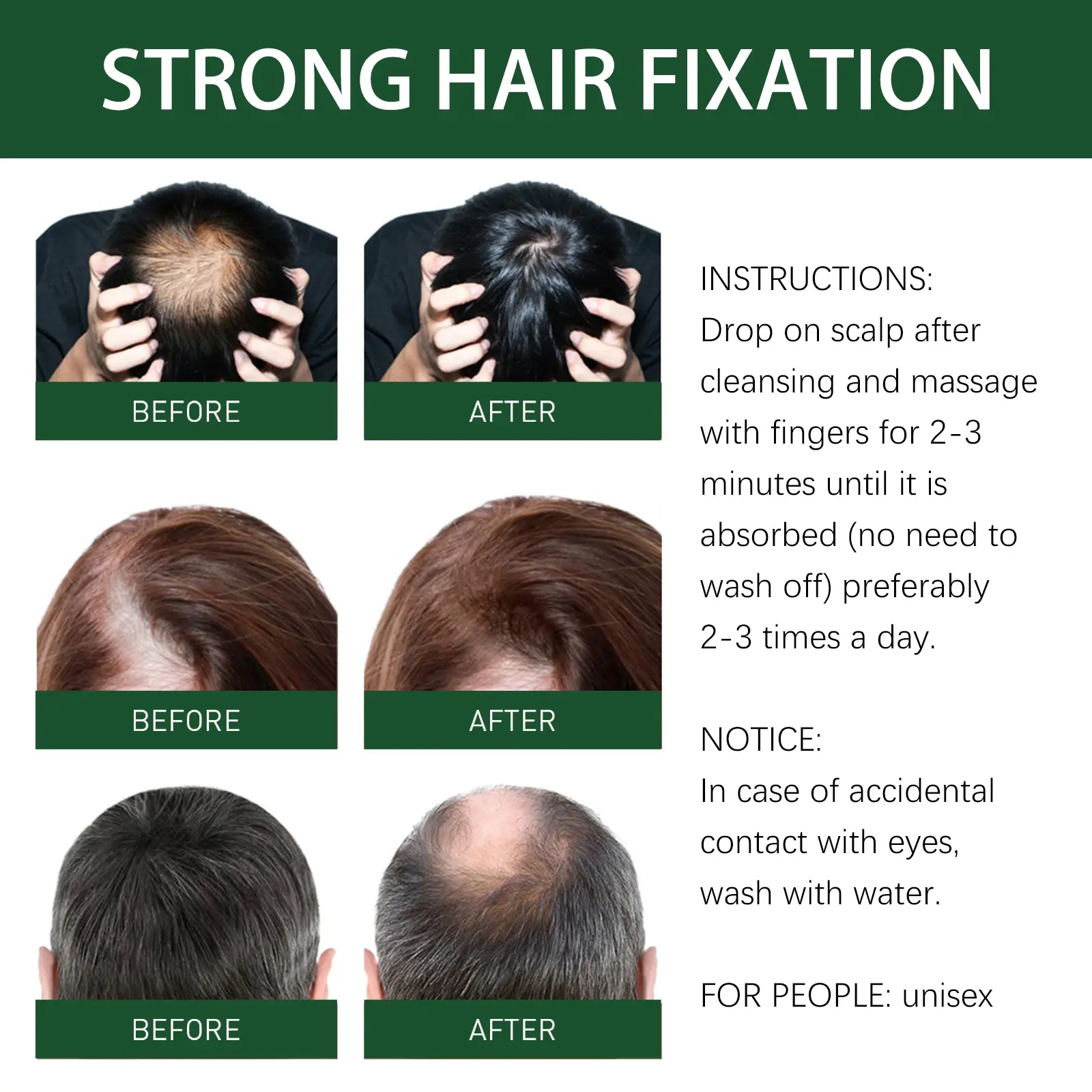 Ginger Hair Essence Nourishing Hair Oil for Damaged Hair - West&Month 4 ginger hair essence nourish ginger solution West Month 661 9480