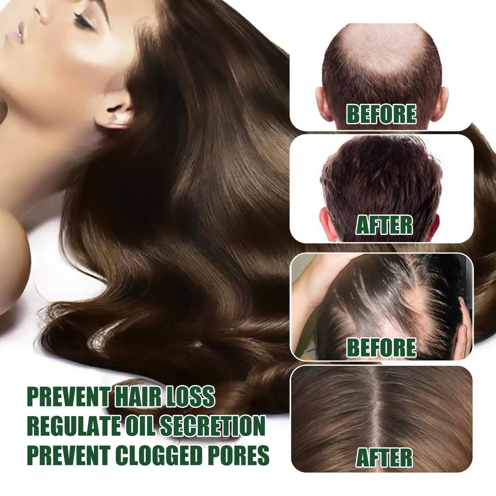 Ginger Hair Essence Nourishing Hair Oil for Damaged Hair - West&Month 9 ginger hair essence nourish ginger solution West Month 661 9485