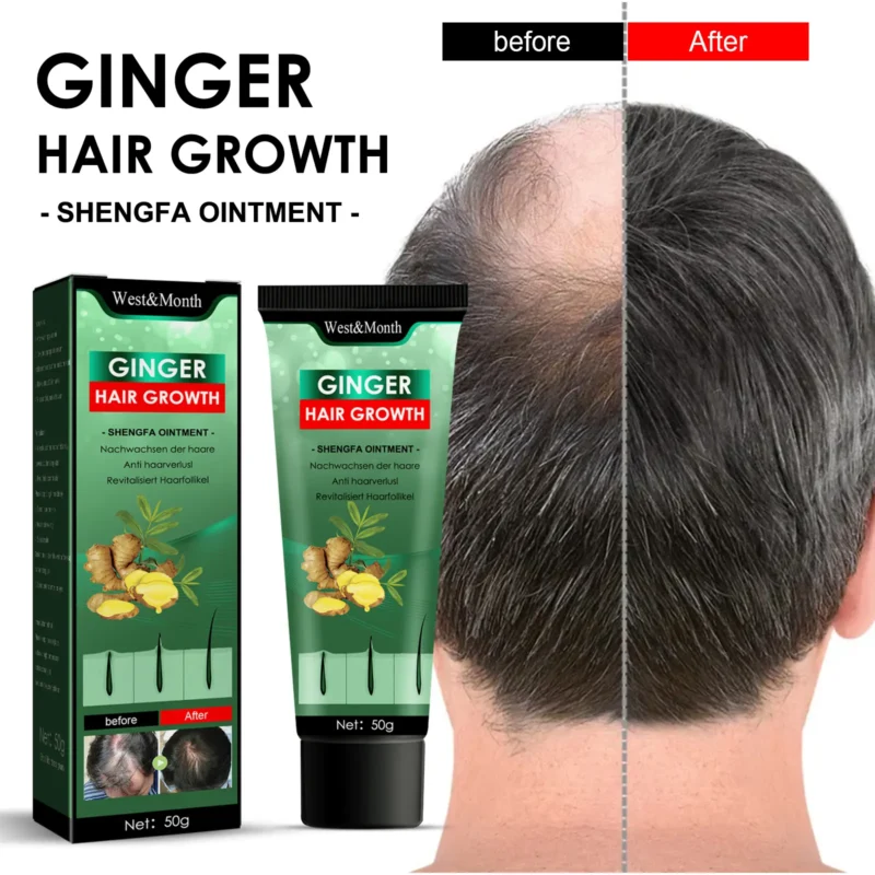 ginger hair ointment moisturize thicken prevent loss West Month 196 3544