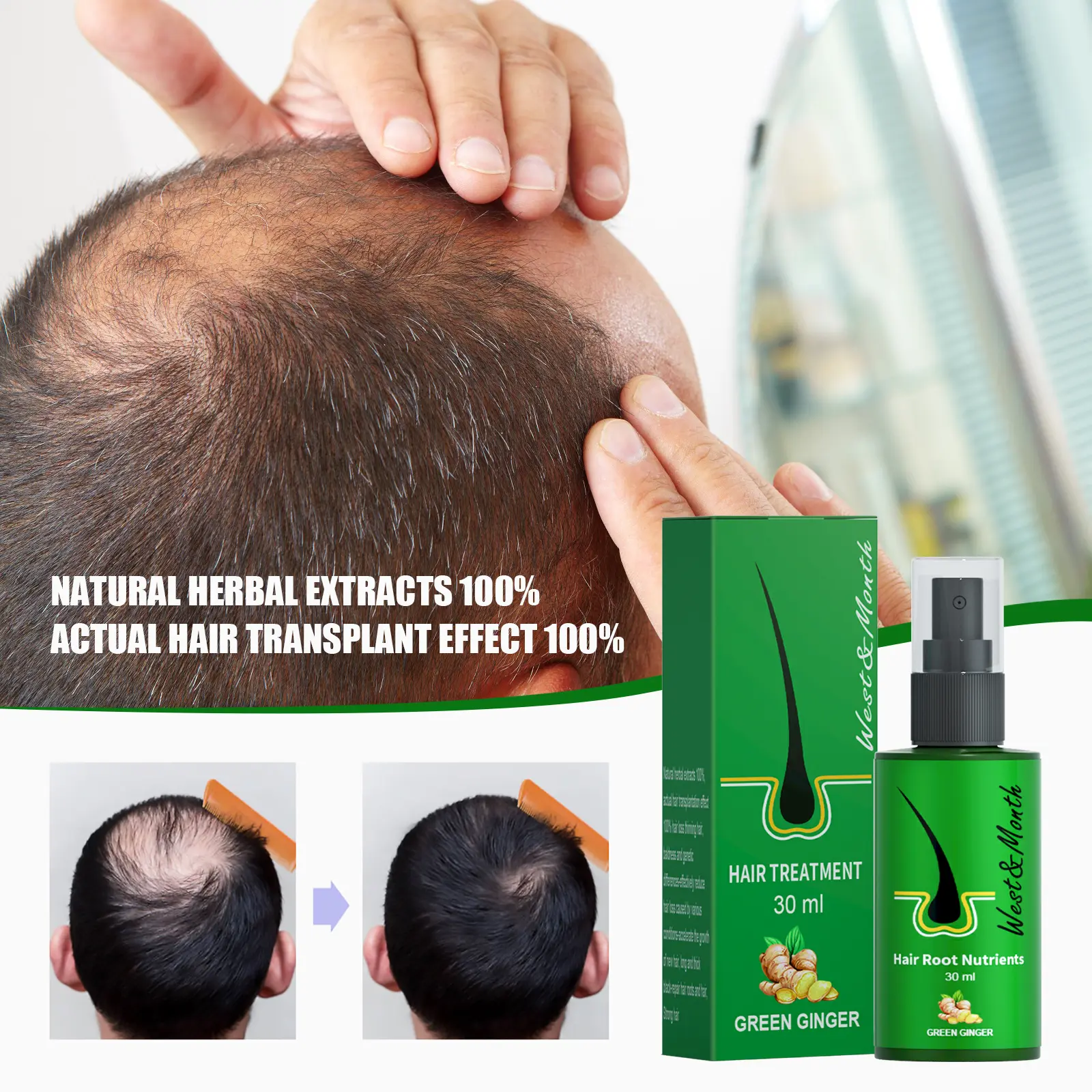 Ginger Hair Treatment Spray - Moisturizing & Nourishing - West&Month 1 ginger hair spray gentle moisturize repair West Month 437 6751