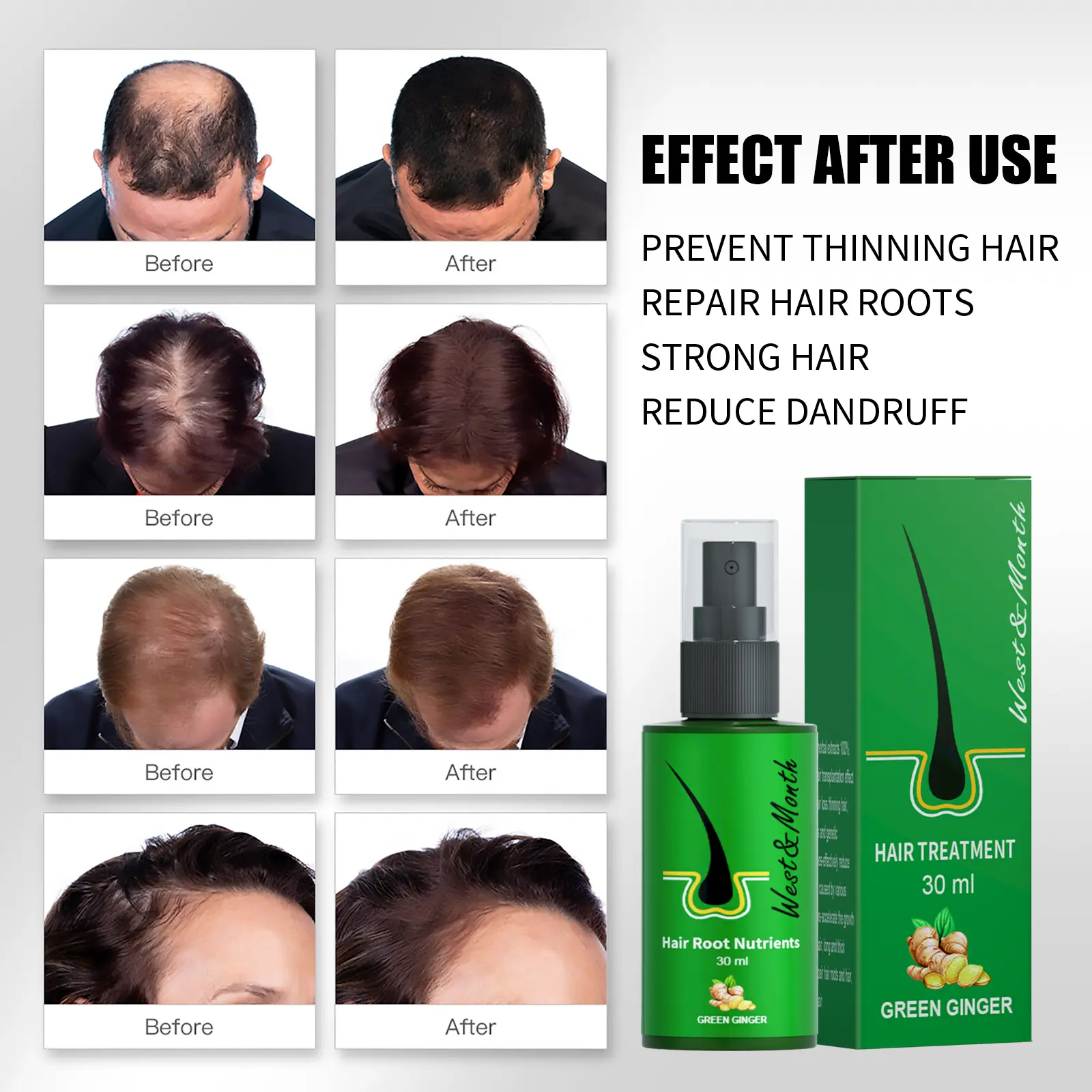 Ginger Hair Treatment Spray - Moisturizing & Nourishing - West&Month 4 ginger hair spray gentle moisturize repair West Month 437 6754