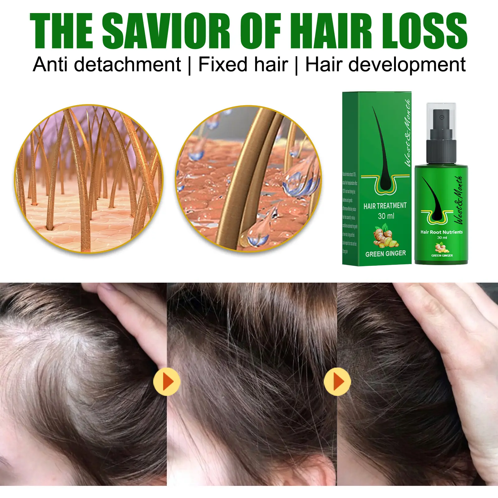 Ginger Hair Treatment Spray - Moisturizing & Nourishing - West&Month 5 ginger hair spray gentle moisturize repair West Month 437 6755