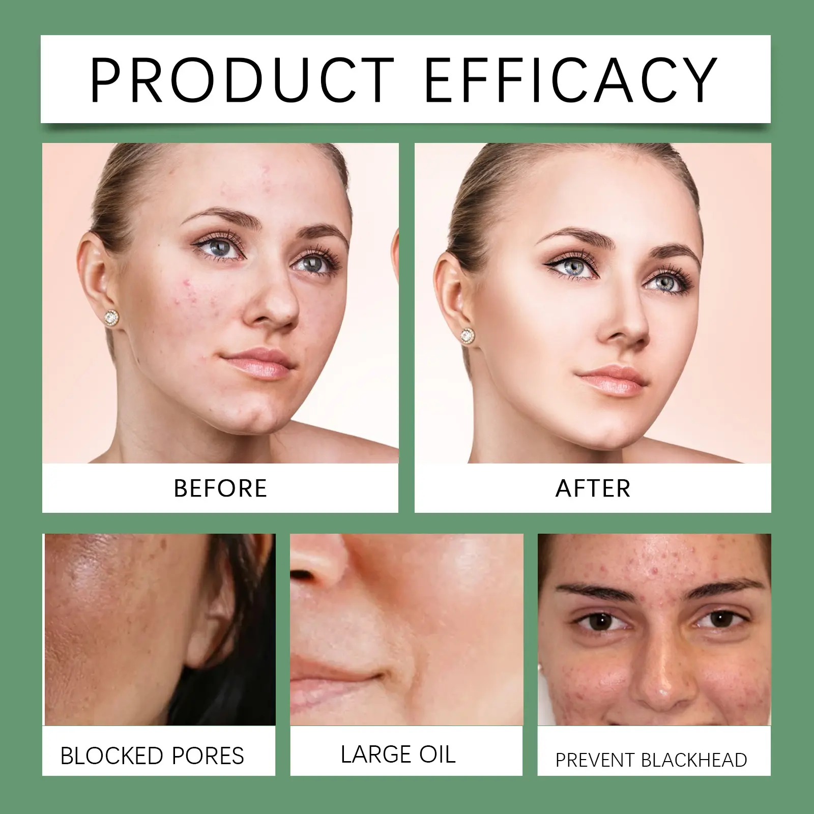 Glycolic Acid Hydrating Toner with Aloe Vera for Smooth Skin - West&Month 9 glycolic acid toner gently moisturize hydrate West Month 090 2243