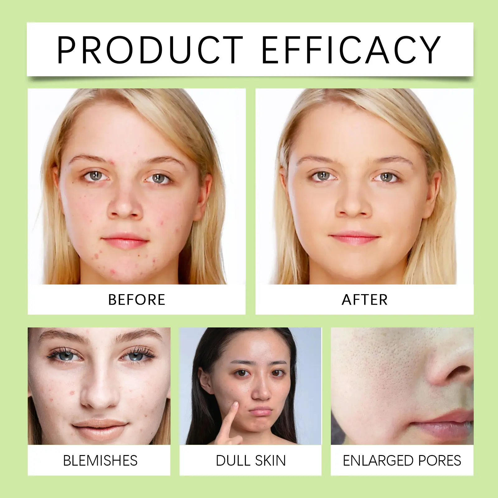 Green Tea Foam Cleanser Refreshing Gentle Face Wash by West&Month 9 green tea foam cleanser gentle pore refresh moist West Month 642 9309