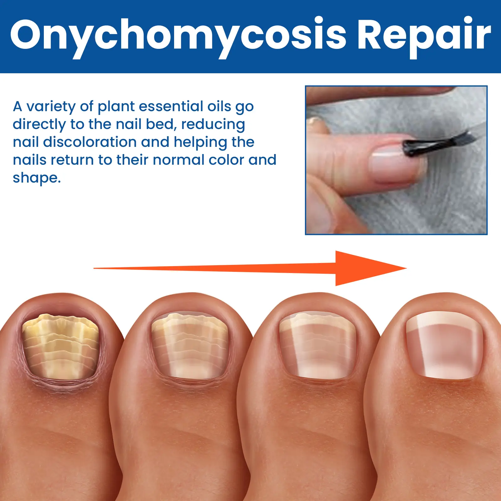 Grey Nail Repair Solution Thickening & Brightening Treatment West&Month 6 grey nail repair solution remove soften West Month 071 1990