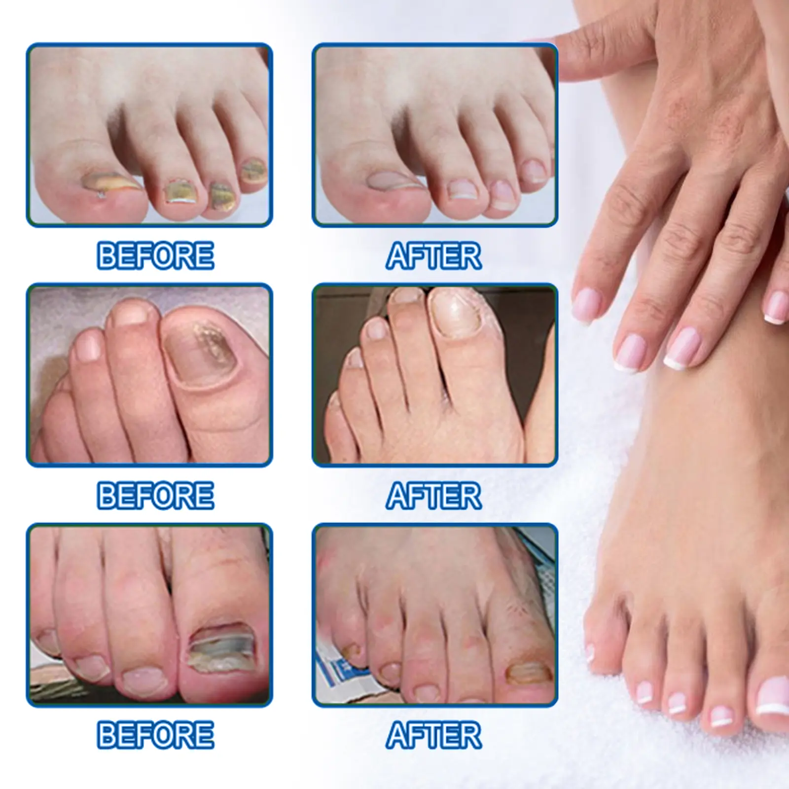 Grey Nail Repair Solution Thickening & Brightening Treatment West&Month 7 grey nail repair solution remove soften West Month 071 1991