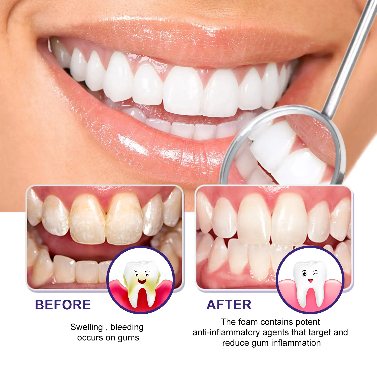 Gum Smoothing Foam for Healthy Gums and Oral Care - West&Month 7 gum smoothing foam clean stains whiten teeth West Month 384 6026