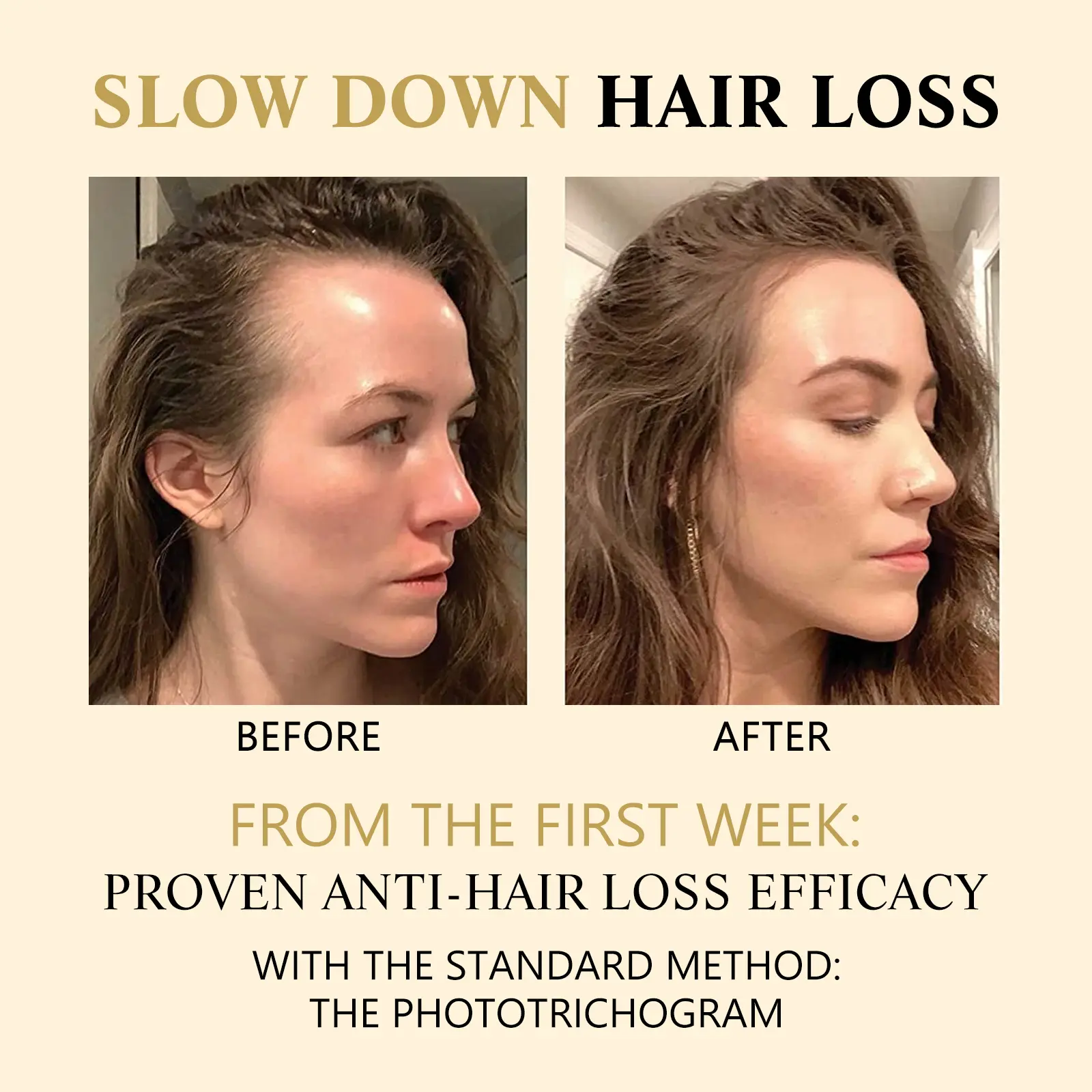 Hair Darkening Strengthening Essence with Scalp Massage Ball | West&Month 5 hair boost essence scalp massage thicken West Month 097 2338