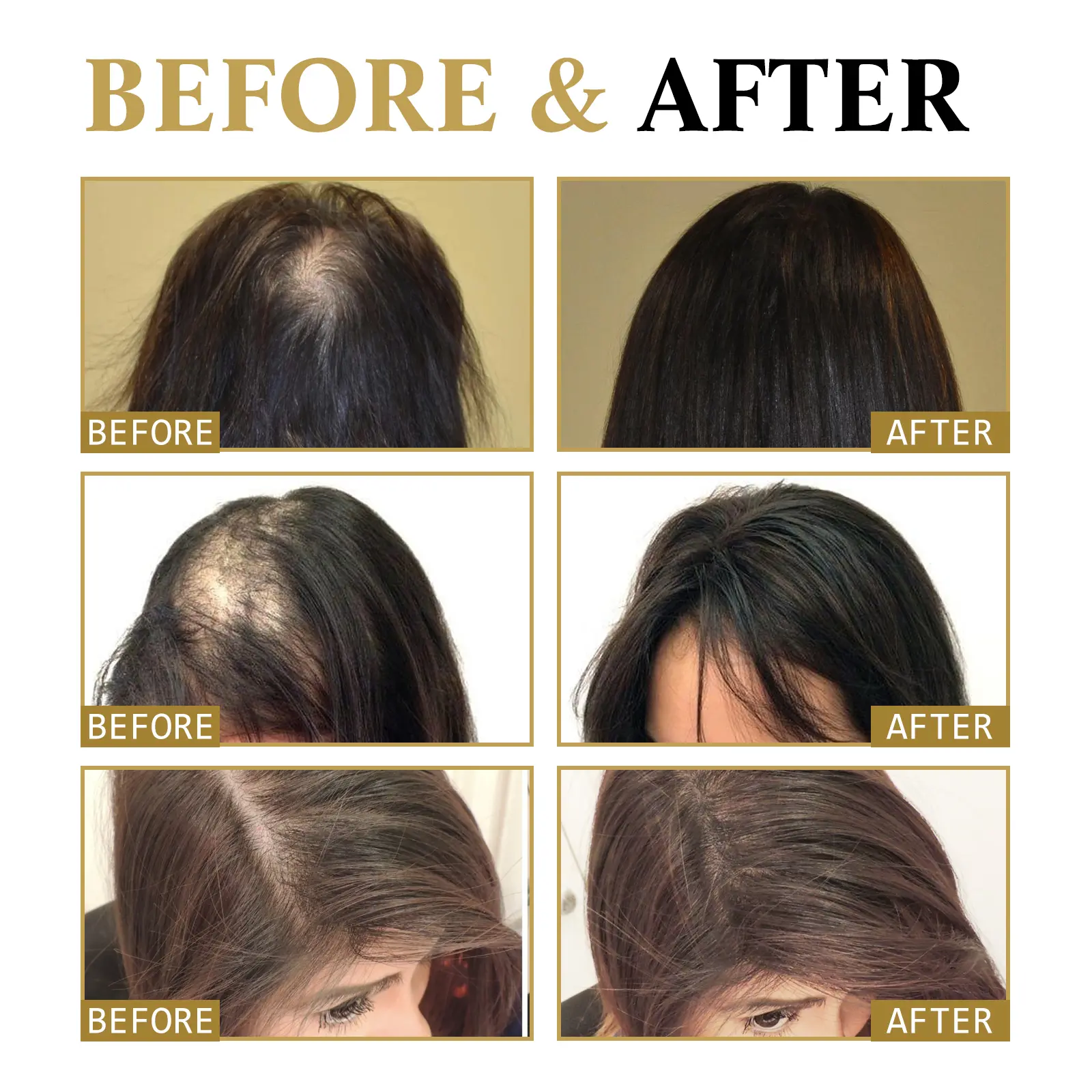Hair Darkening Strengthening Essence with Scalp Massage Ball | West&Month 8 hair boost essence scalp massage thicken West Month 097 2341