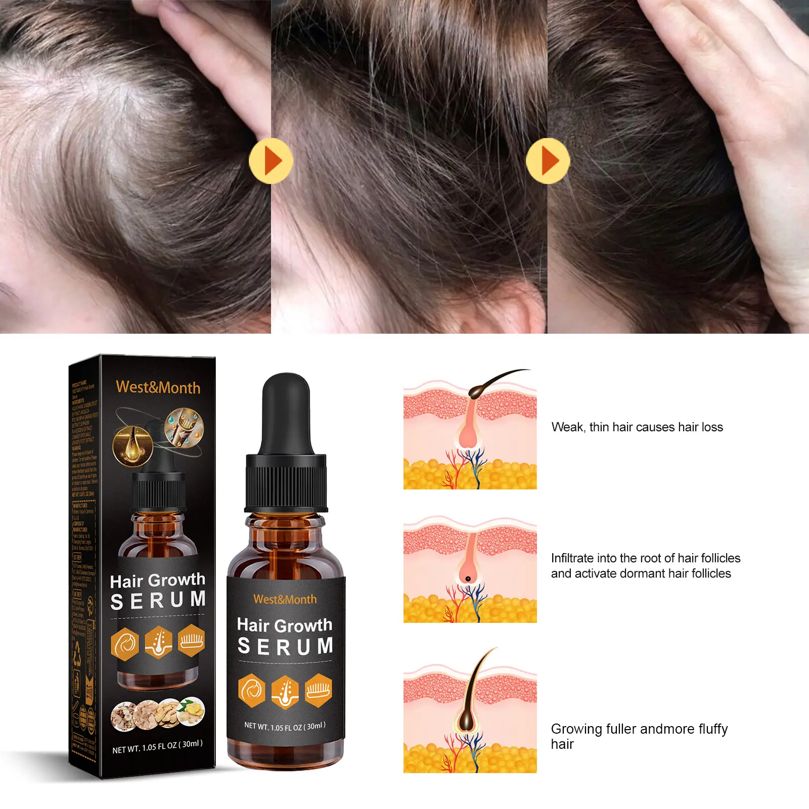 Hair Essential Oil for Nourishing & Moisturizing - West&Month 9 hair care oil moisturize nourish soften West Month 057 1826