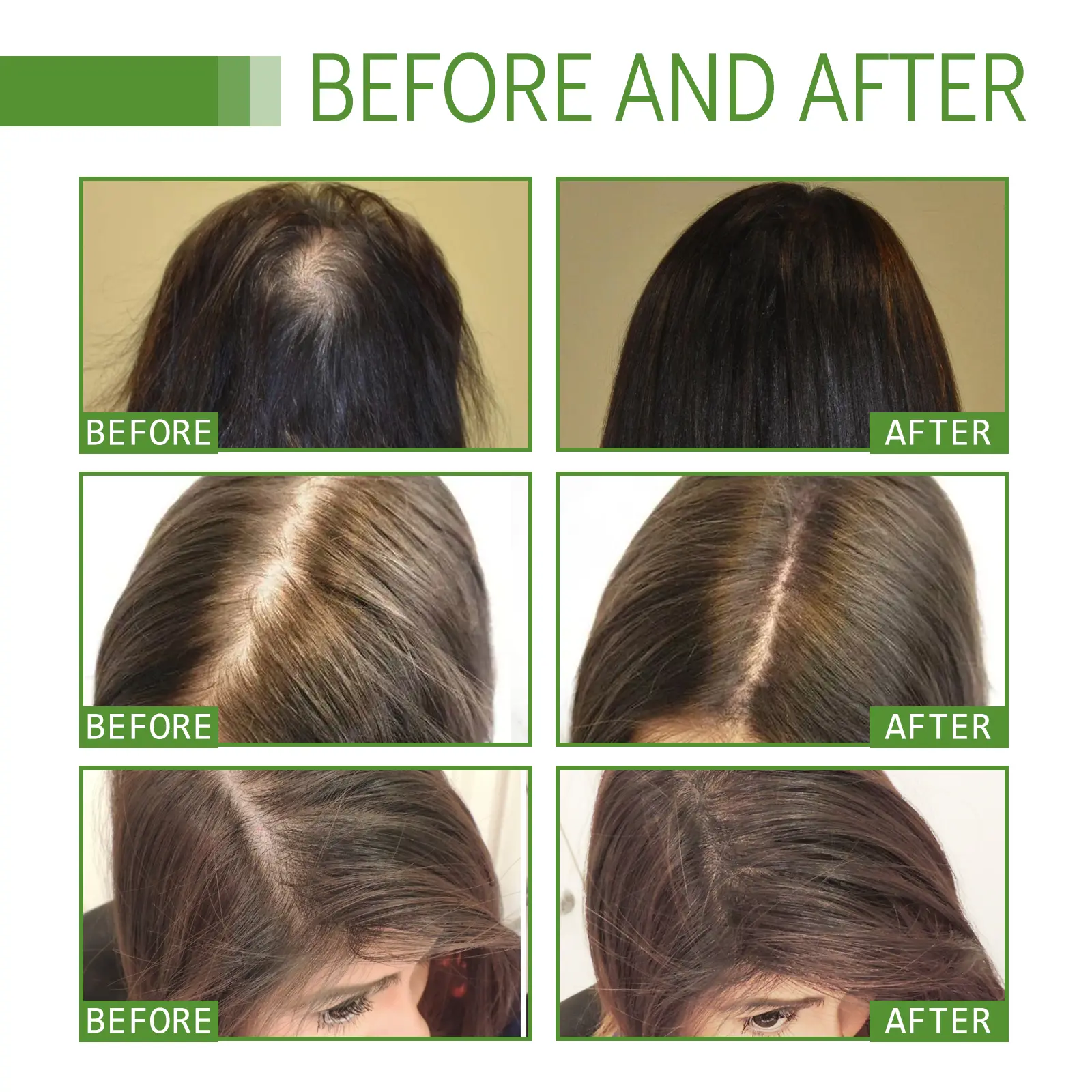Essential Oil for Dry Hair Moisturizing Shine Treatment - West&Month 7 hair care oil protect dry moisturize soften West Month 232 4030
