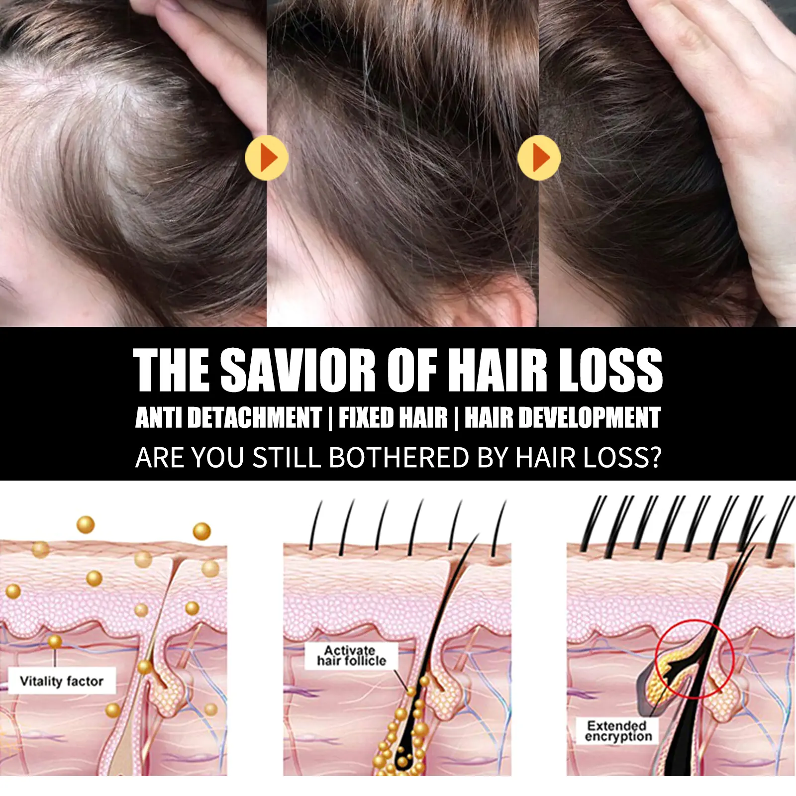 Essential Oil for Hair: Strengthening & Thickening Formula - West&Month 6 hair care oil strengthen moisten thicken West Month 070 1977
