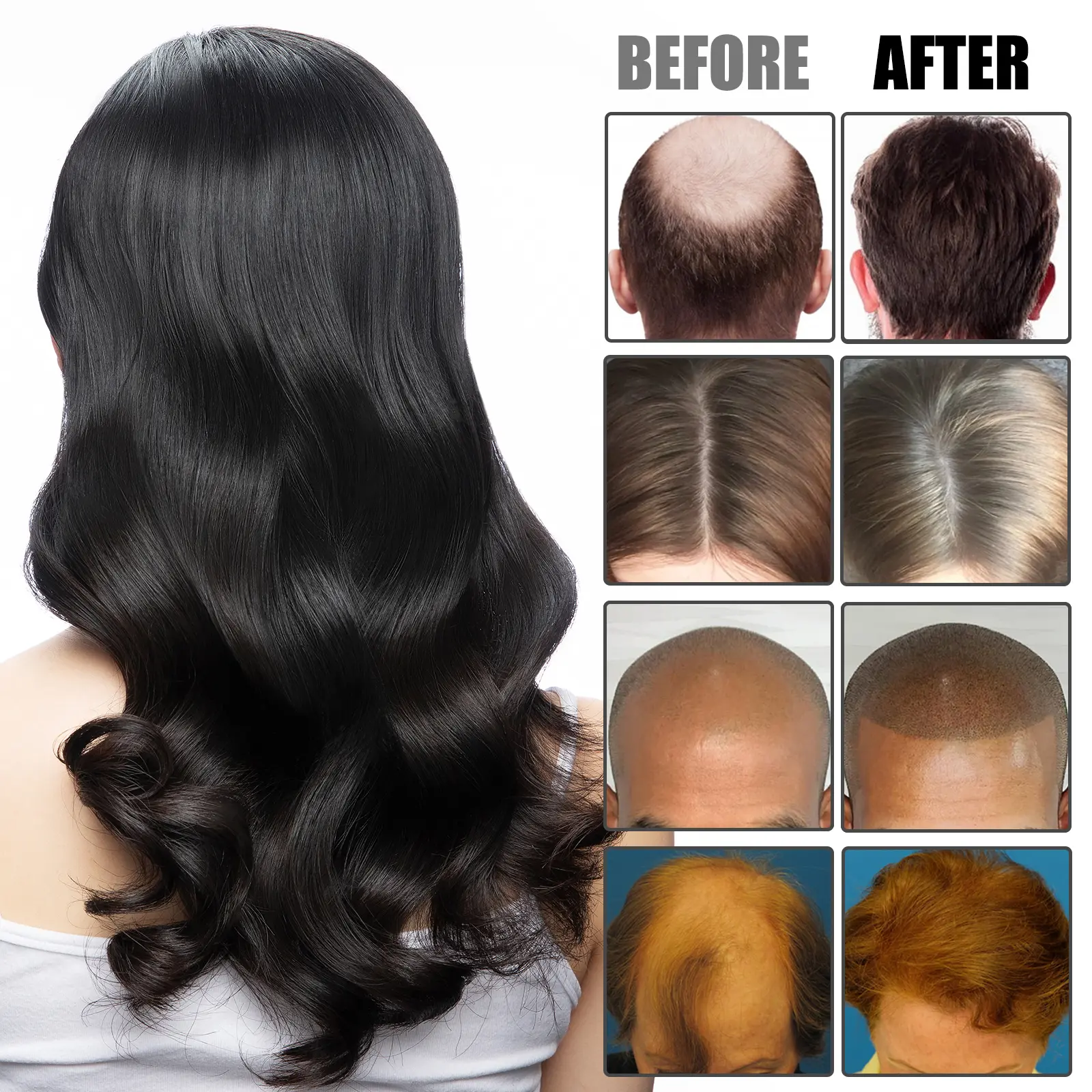 Essential Oil for Hair: Strengthening & Thickening Formula - West&Month 7 hair care oil strengthen moisten thicken West Month 070 1978