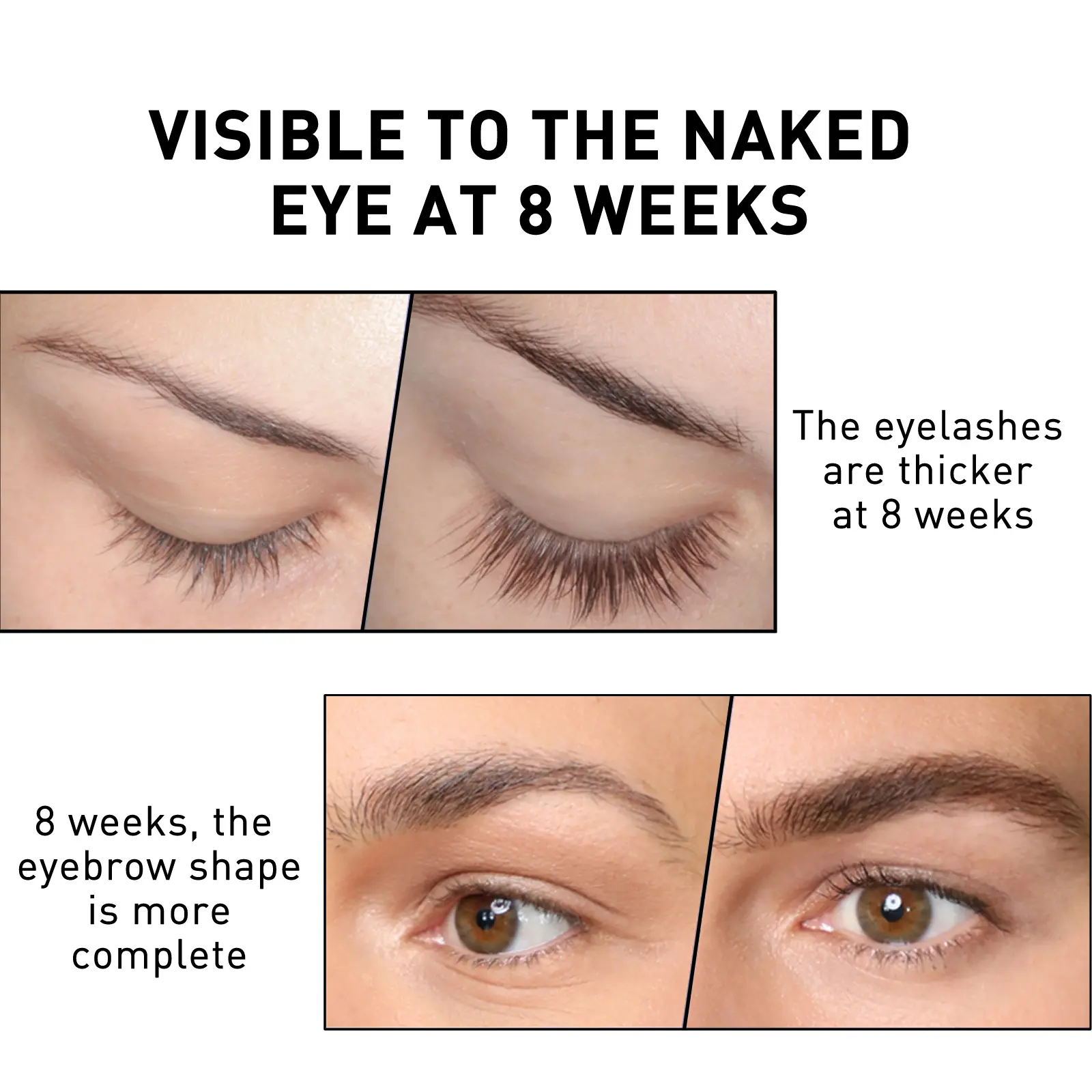 Eyelash Serum for Lash Conditioning - Hair Dense - West&Month 7 hair dense eyelash serum long curl thick West Month 223 3908