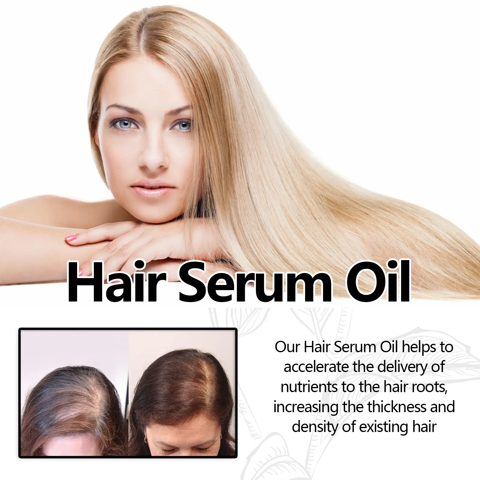 Hair Dense Essential Oil for Stronger, Fuller Hair | West&Month 8 hair dense oil strengthen prevent loss smooth West Month 147 2954