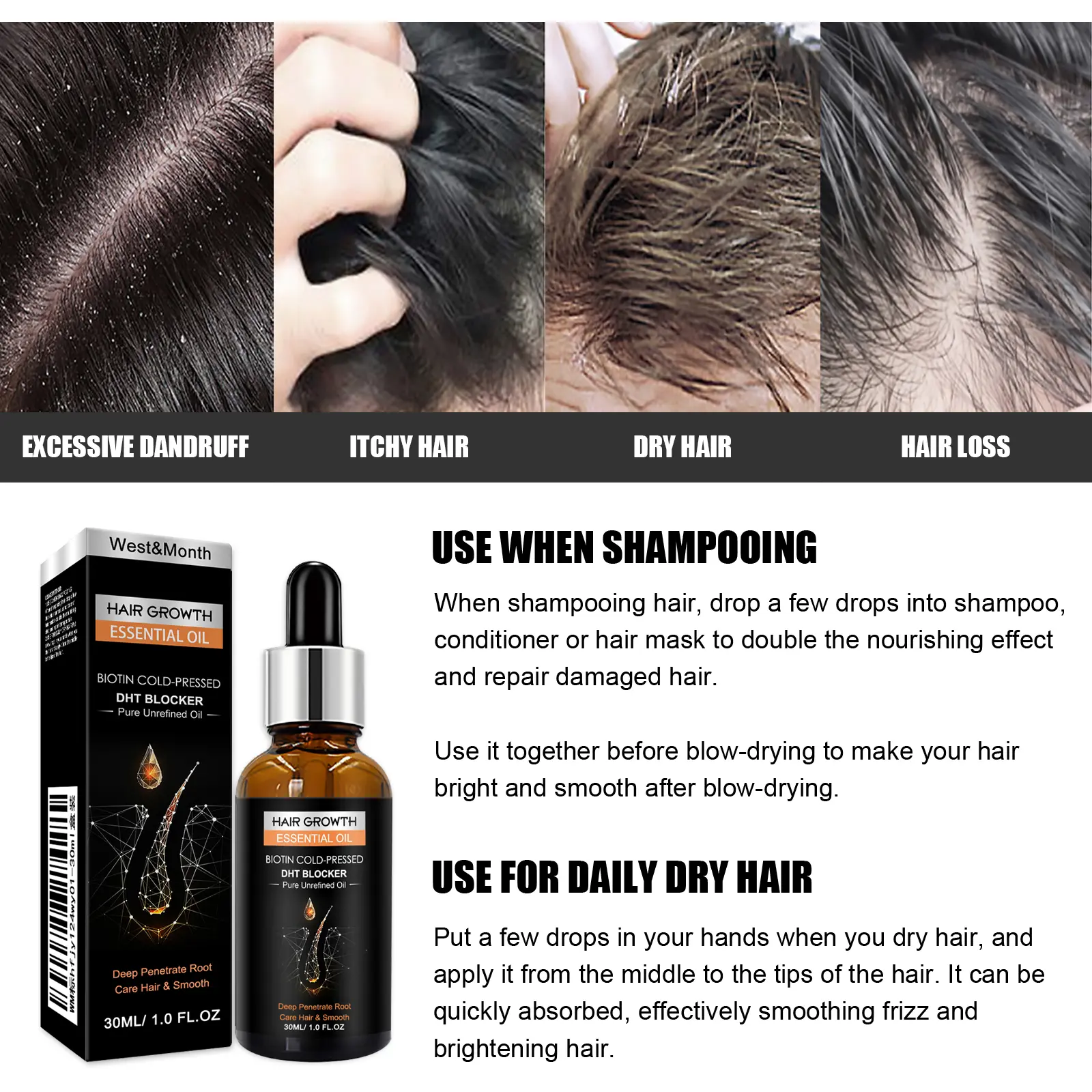 Hair Growth Essential Oil for Dry Hair Repair & Moisture | West&Month 4 hair growth essential oil dense repair dry hair West Month 042 1642