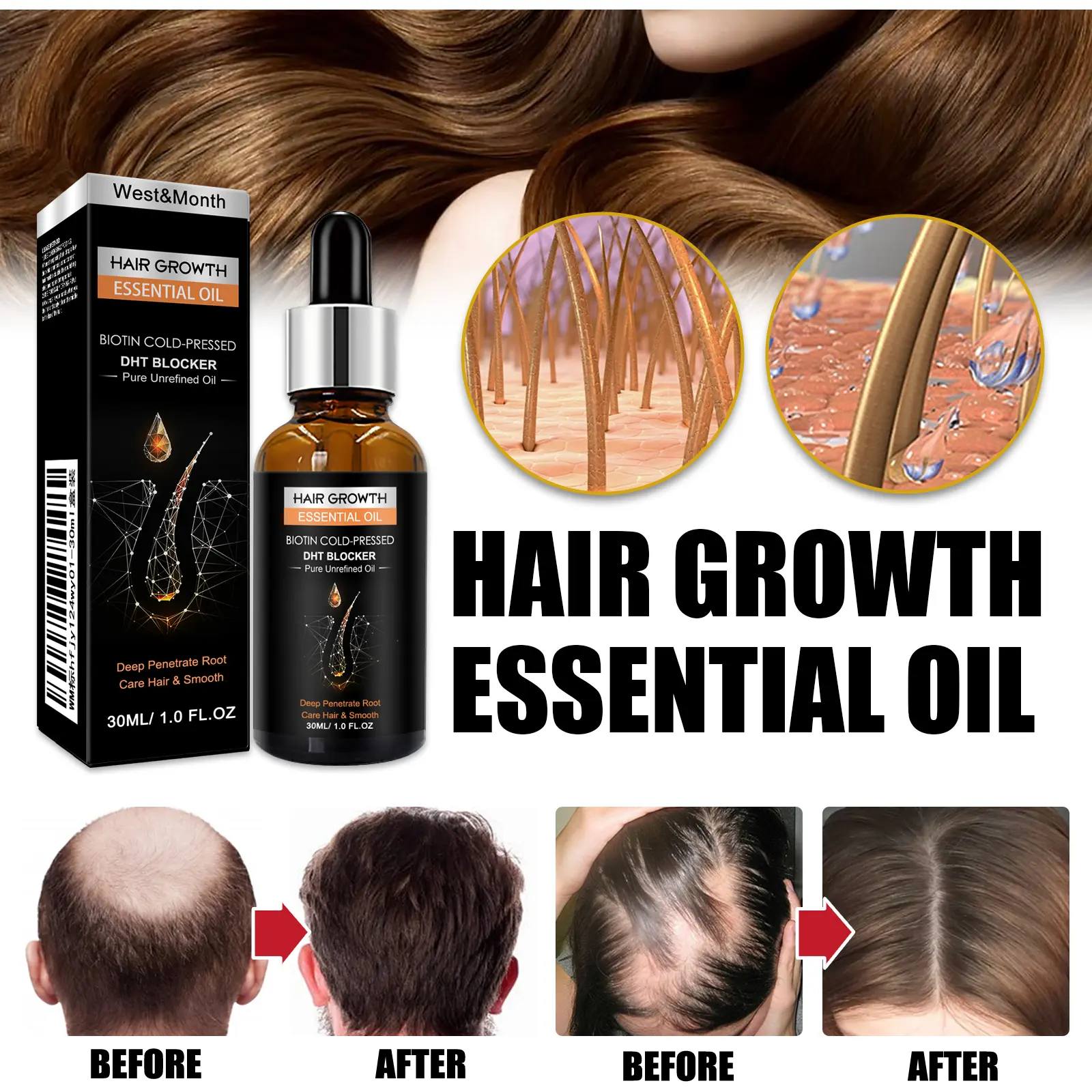 Hair Growth Essential Oil for Dry Hair Repair & Moisture | West&Month 5 hair growth essential oil dense repair dry hair West Month 042 1643