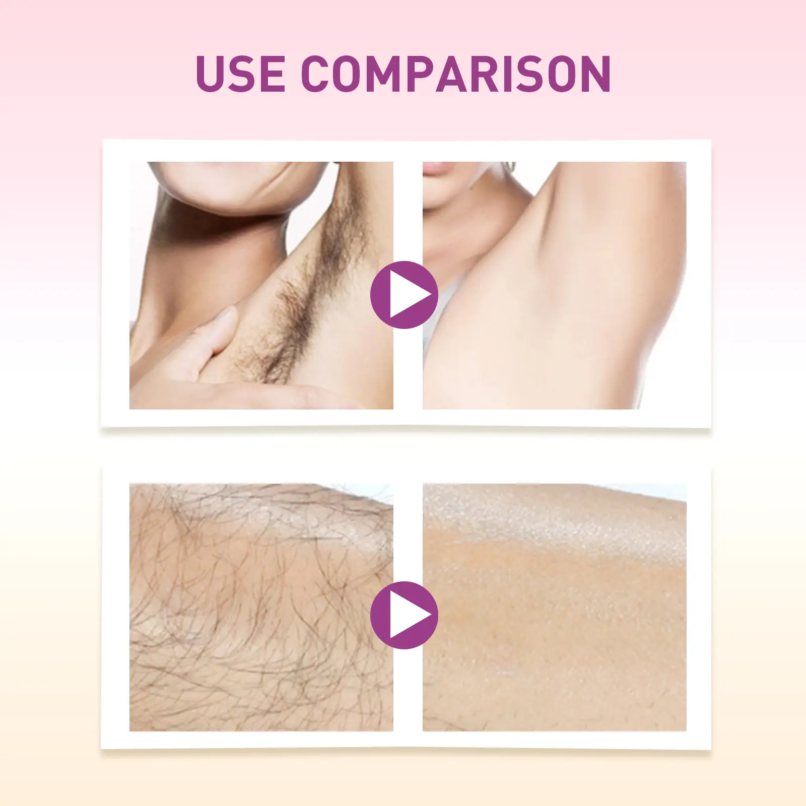 Hair Removal Spray for Sensitive Skin - West&Month Mild Formula 10 hair removal spray mild non irritating full action West Month 102 2404