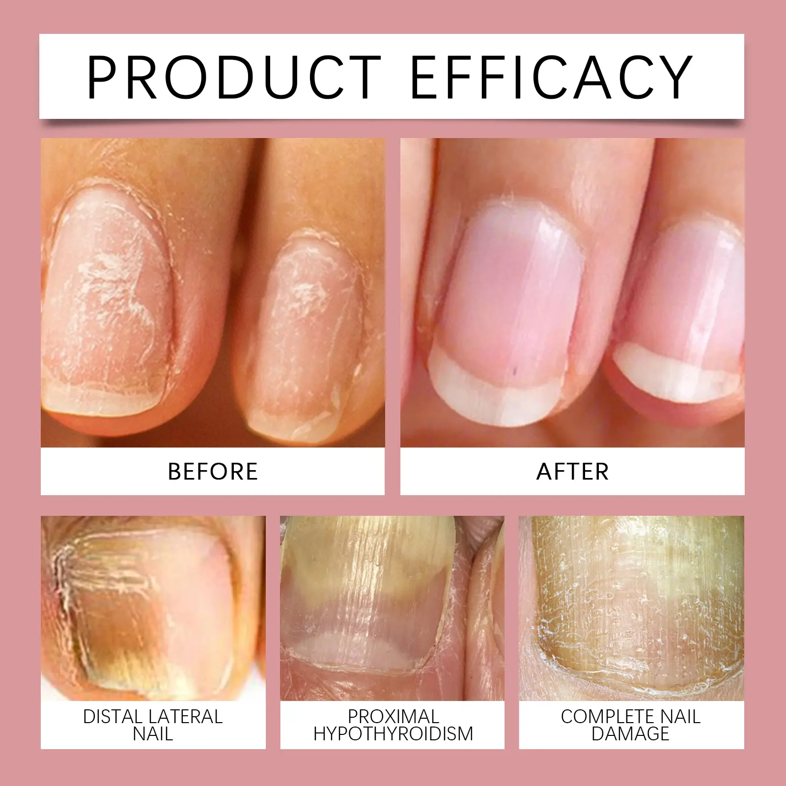 Nail Care Solution Nourishing Moisturizer for Hand & Foot - West 9 hand foot nail care solution nourish repair West Month 095 2315