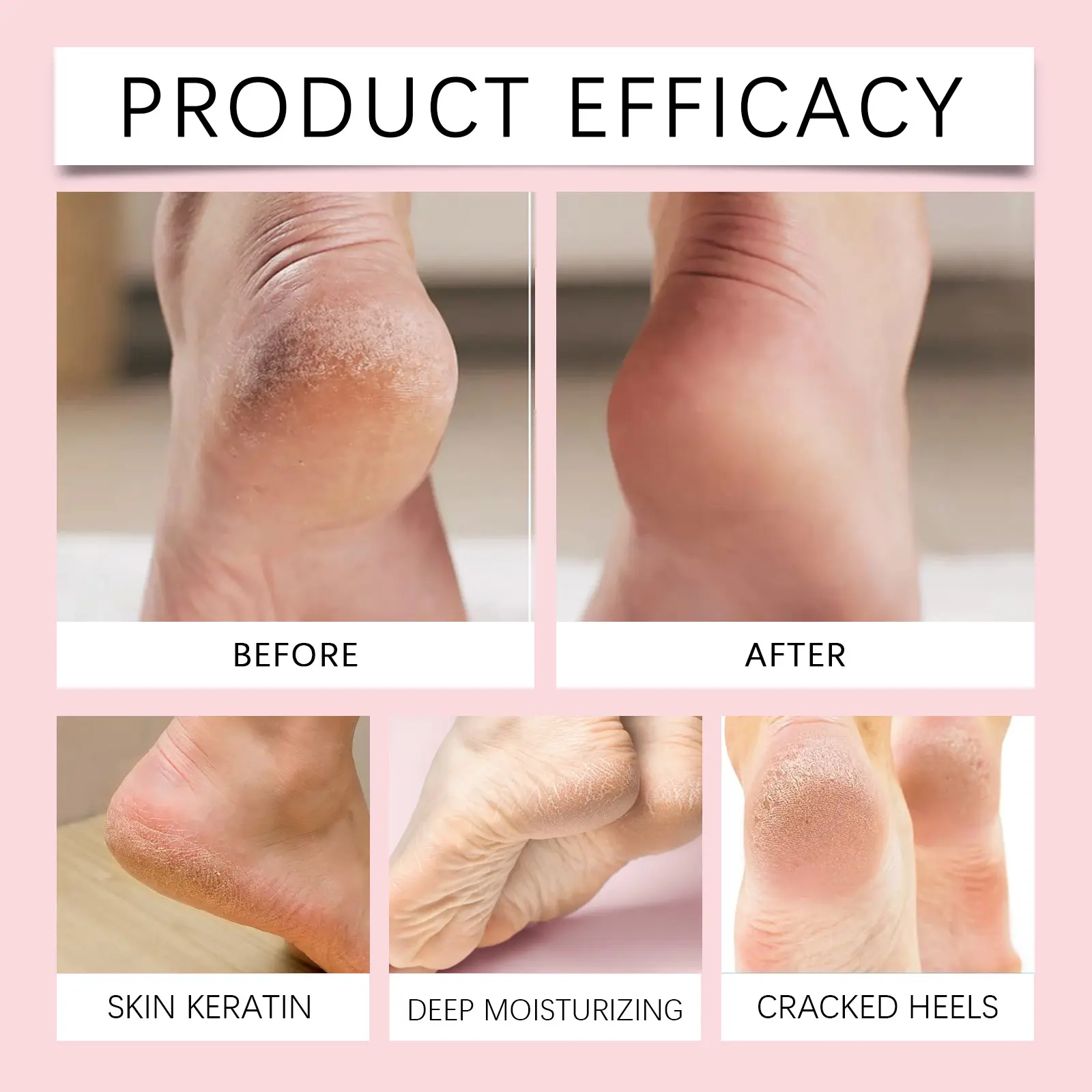 Heel Repair Stick for Soft Smooth Feet - West&Month 9 heel repair stick foot moisturize soft smooth West Month 538 8217