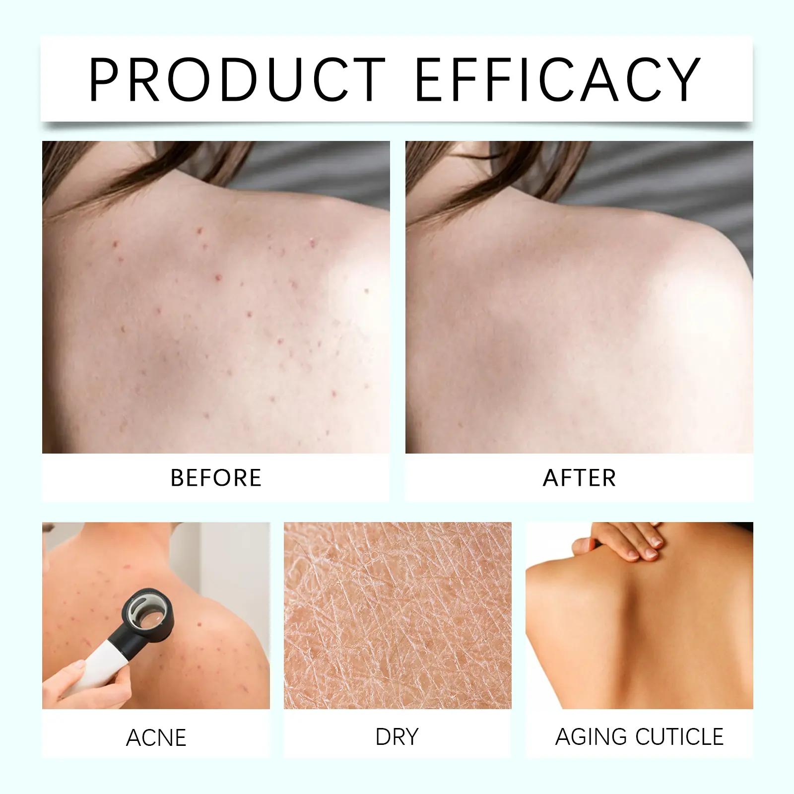Herbal Back Care Spray Hydrating Moisturizer for Smooth Skin - West&Month 12 herbal back spray gentle hydrating smooth West Month 125 2675