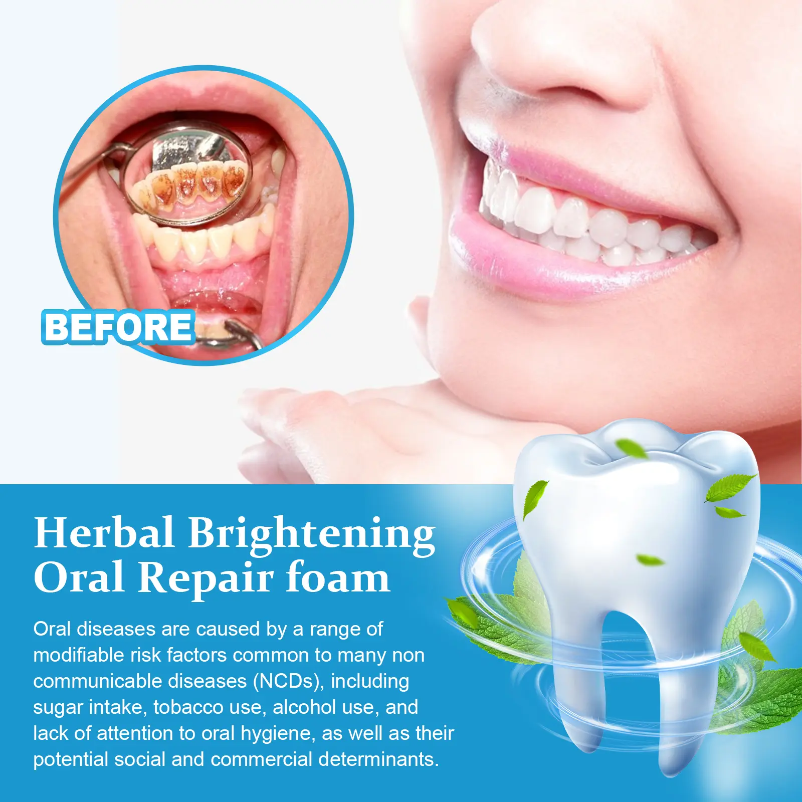 Herbal Teeth Whitening Foam for Bad Breath & Stain Removal - West&Month 6 herbal oral foam clean breath stains whiten West Month 433 6706