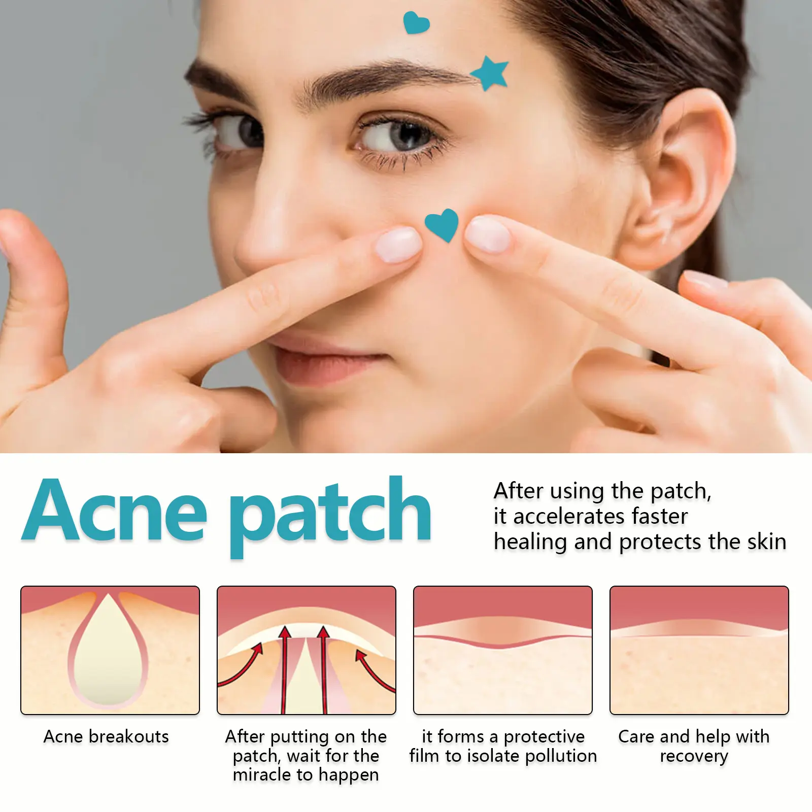 Hydrocolloid Acne Patches - Invisible Waterproof Spot Treatment - West&Month 5 hydrocolloidal acne patch repair acne West Month 020 1358