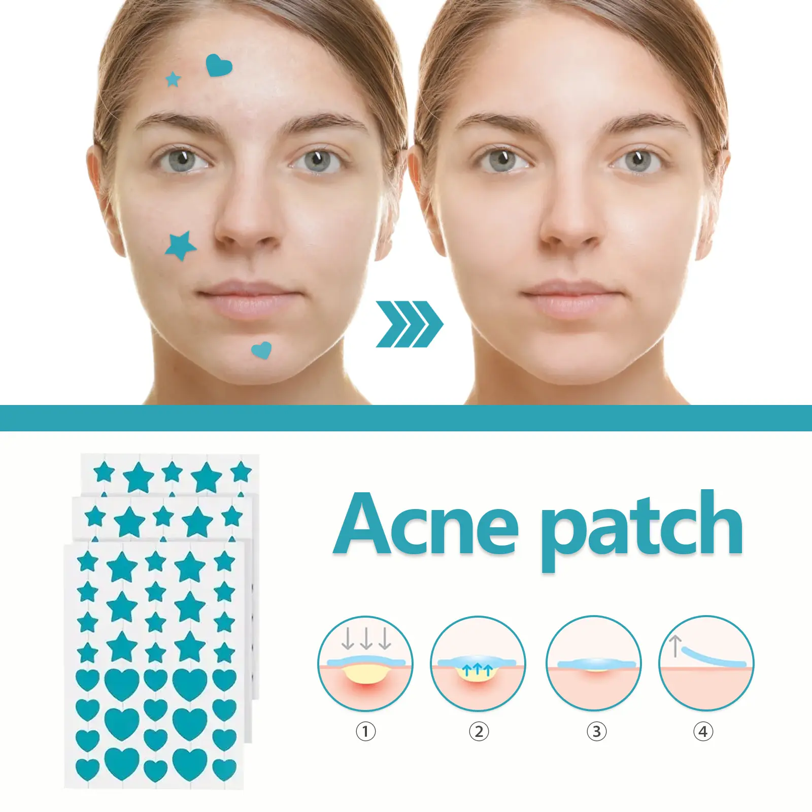 Hydrocolloid Acne Patches - Invisible Waterproof Spot Treatment - West&Month 6 hydrocolloidal acne patch repair acne West Month 020 1359