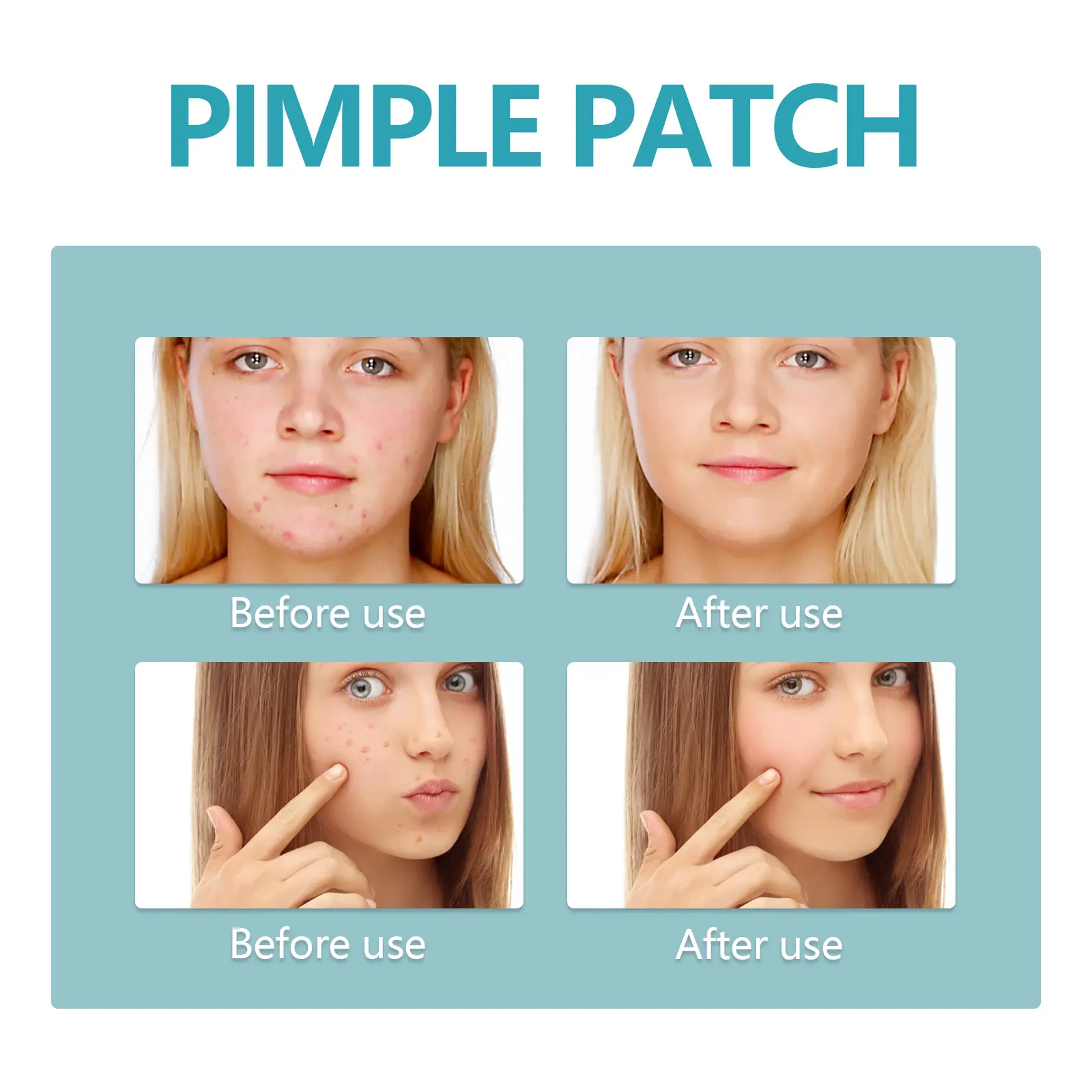 Hydrocolloid Acne Patches - Invisible Waterproof Spot Treatment - West&Month 8 hydrocolloidal acne patch repair acne West Month 020 1361