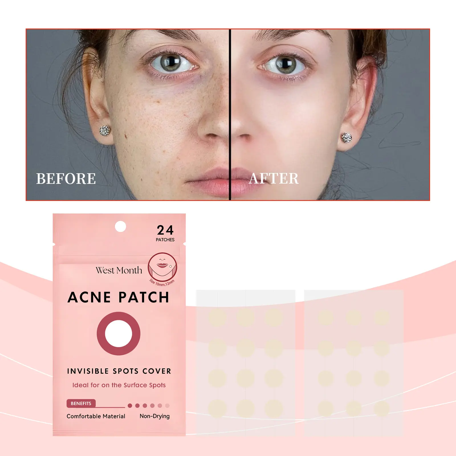 Invisible Acne Patches with Salicylic Acid & Snow Root - West&Month 2 invisible acne patch gentle clean moisturize portable West Month 481 7376