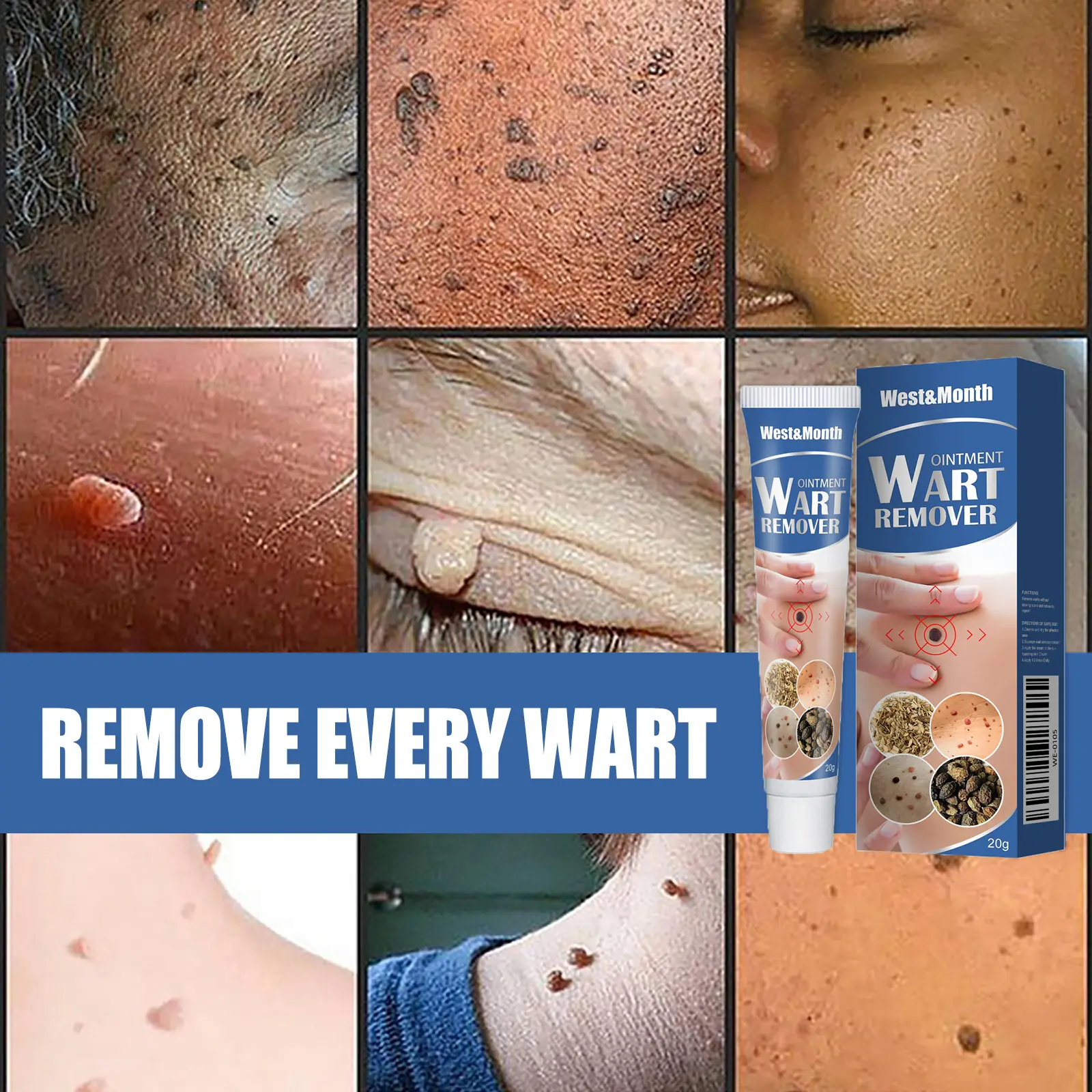 Wart Removal Cream for Clear Skin - West&Month Keu 10 keu cream gently clean hands feet face daily West Month 652 9433