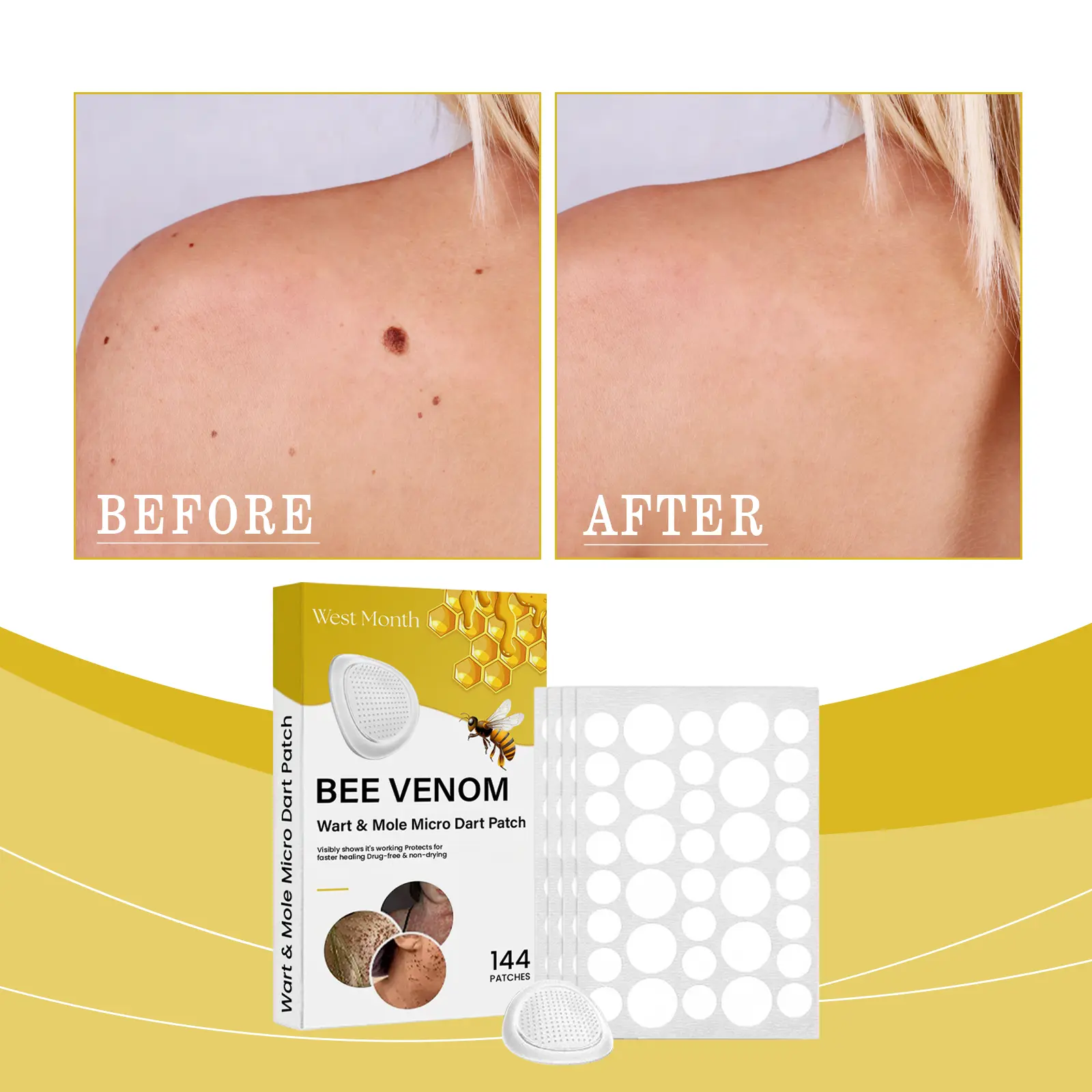 West&Month Keyo Patch for Skin Tag and Wart Removal - Portable Skincare 2 keyo patch gently clean smooth portable West Month 475 7287