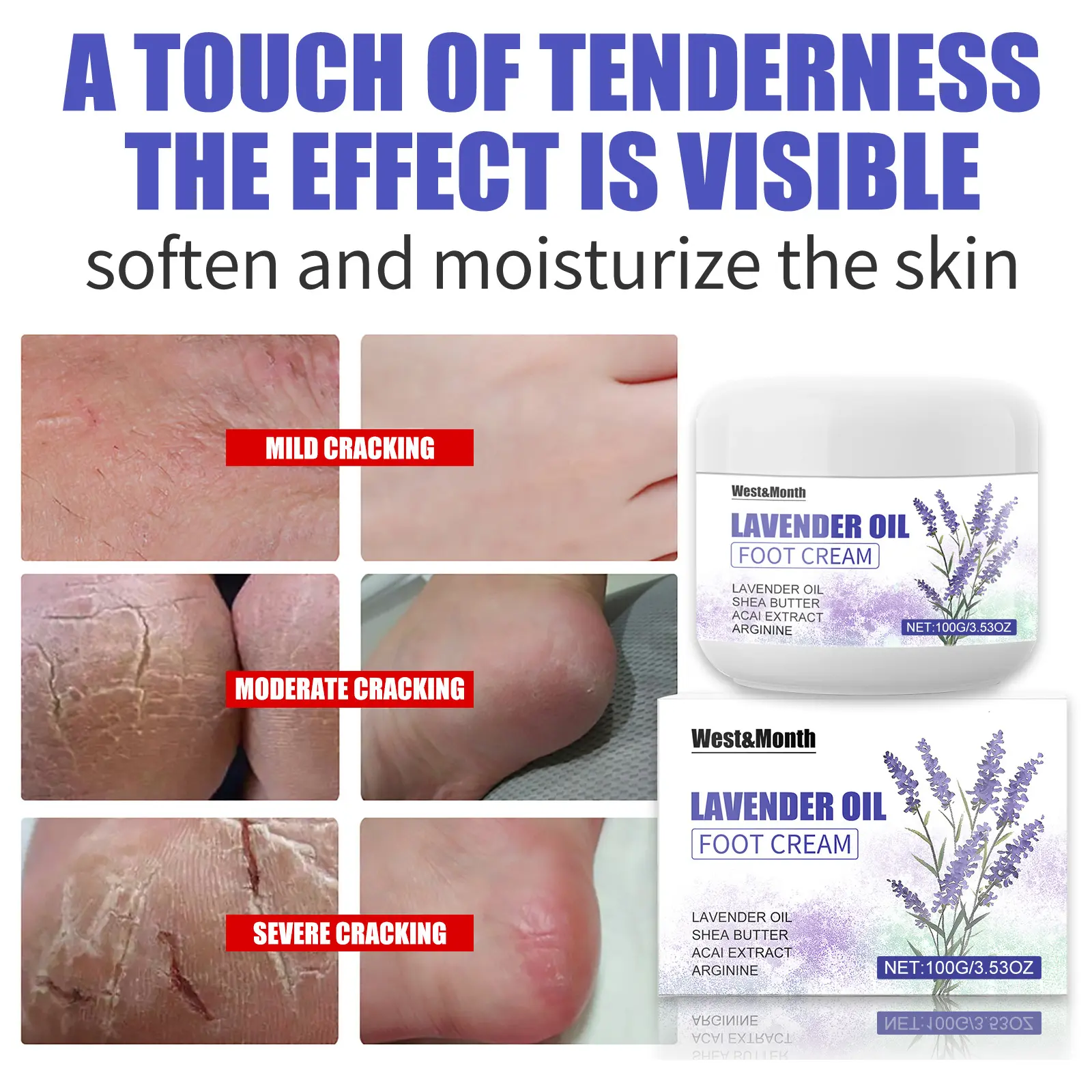 Lavender Oil Foot Cream for Hydrating & Anti-Crack Protection - West&Month 3 lavender foot cream anti freeze crack hydrate West Month 667 9531