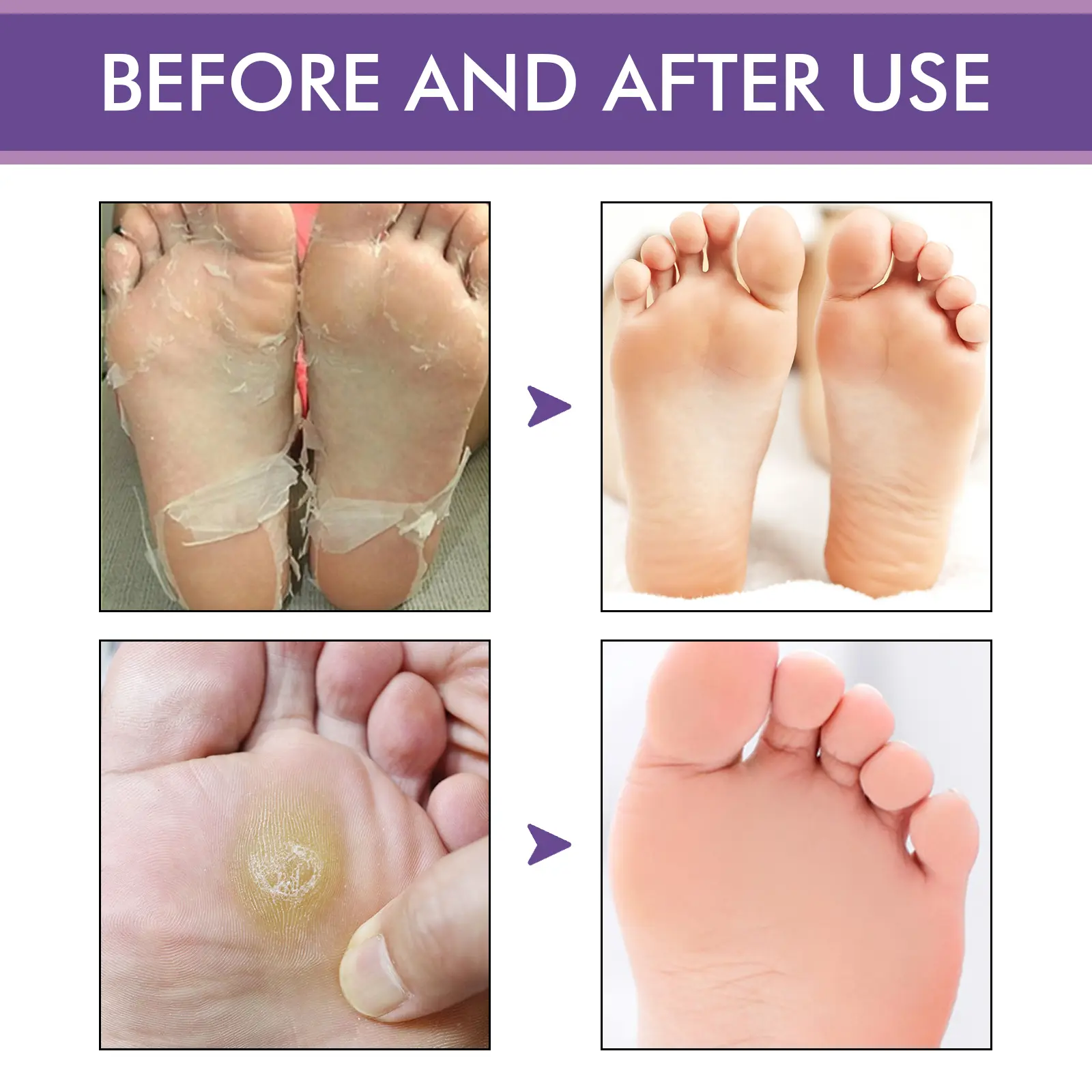 Lavender Foot Mask - Moisturizing Anti-Cracking Care - West&Month 8 lavender peel mask moisturize foot clean keratin West Month 288 4744
