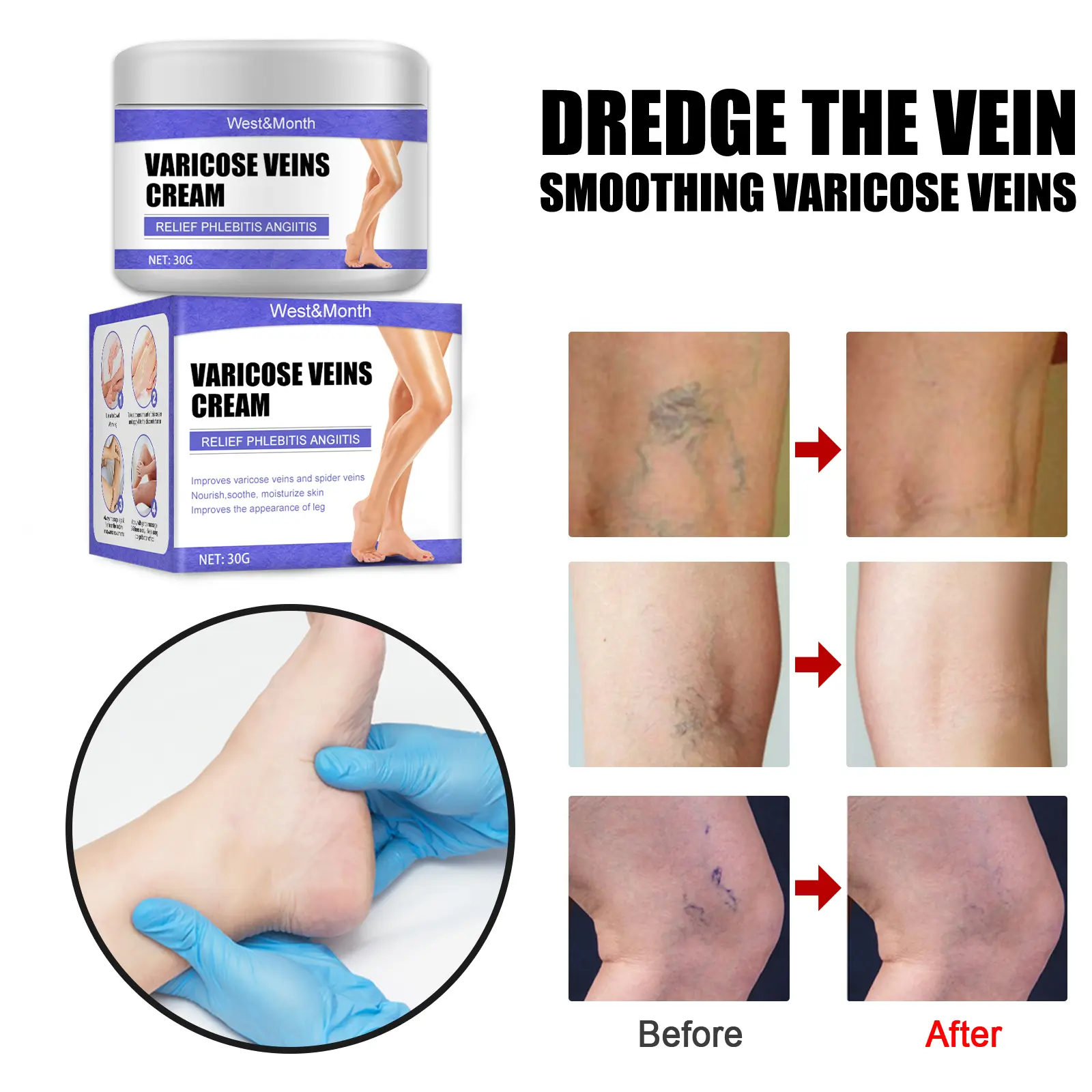 Leg Care Cream for Discomfort and Moisturizing - West&Month 6 leg care cream gentle moisturizing massage West Month 034 1541