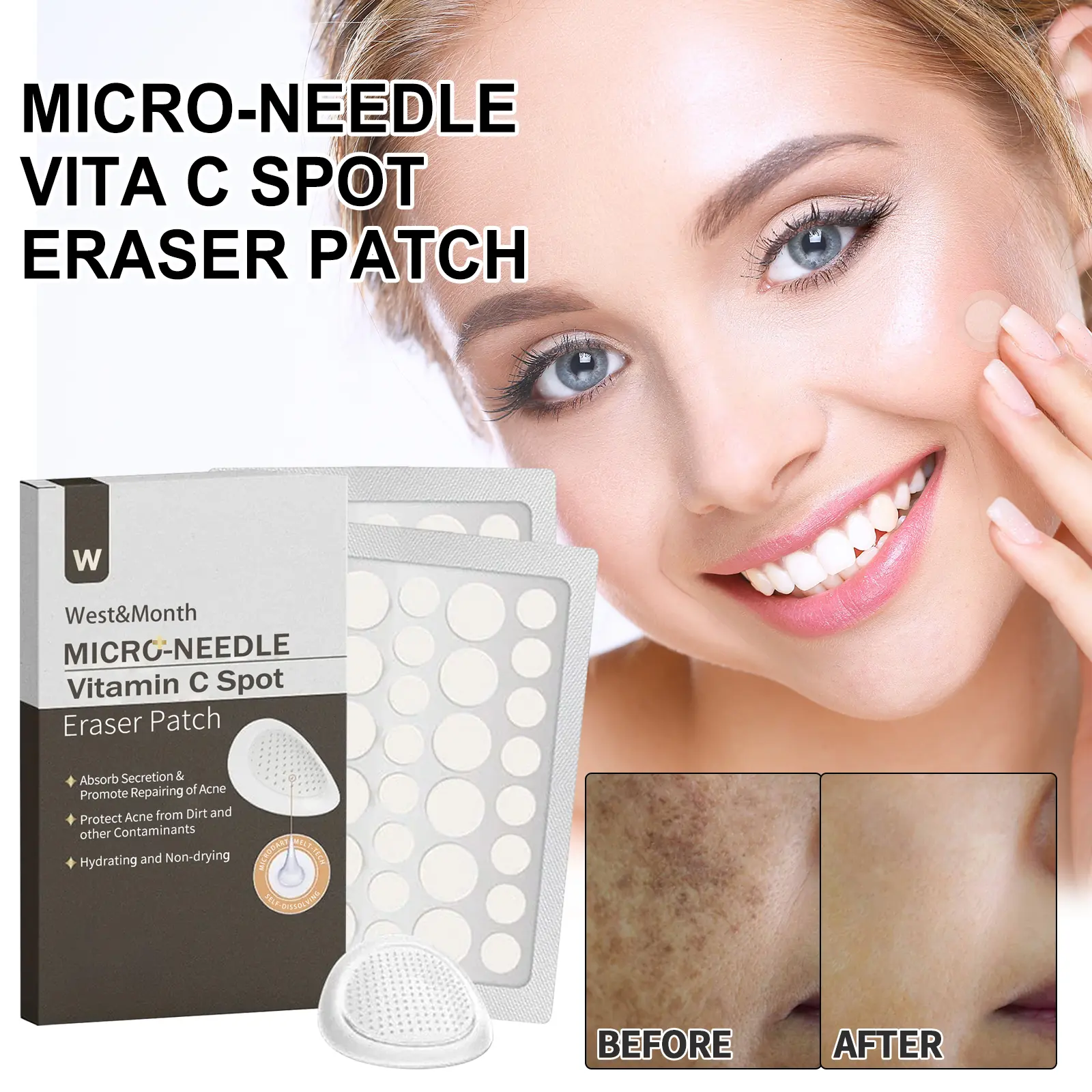 Vitamin C Microneedle Patch for Dark Spots & Acne | West&Month 2 micro needle vita c spot eraser patch West Month 038 1585