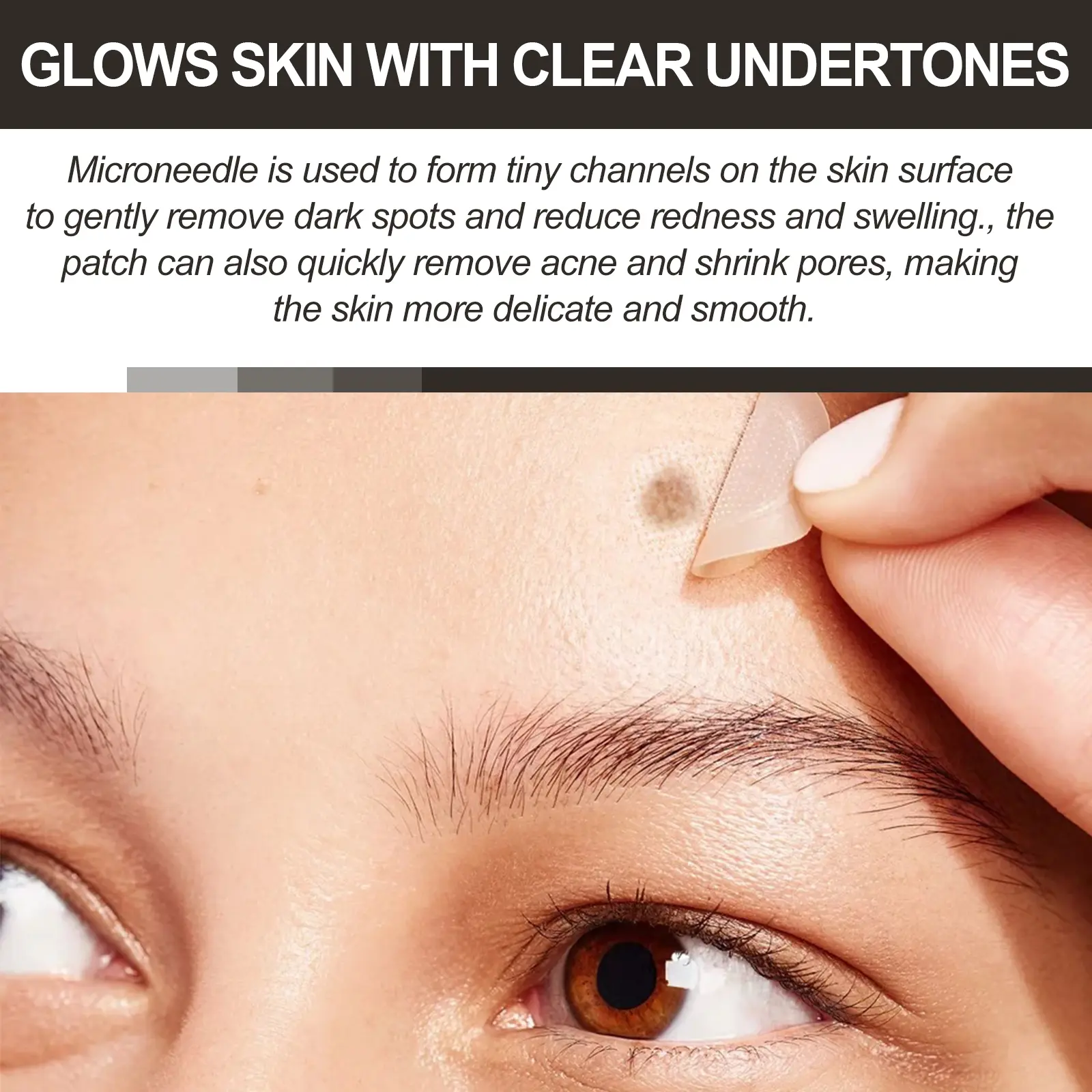 Vitamin C Microneedle Patch for Dark Spots & Acne | West&Month 7 micro needle vita c spot eraser patch West Month 038 1589