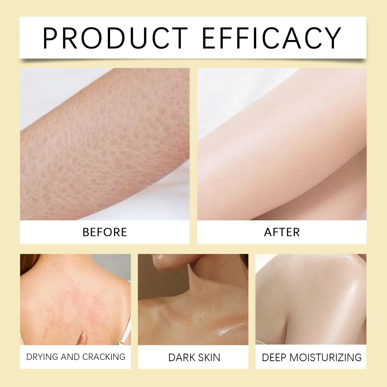 Moisturizing Body Cream for Rough Dull Skin with Shea Butter - West&Month 12 moisturizing body cream restore rough dull skin West Month 145 2926