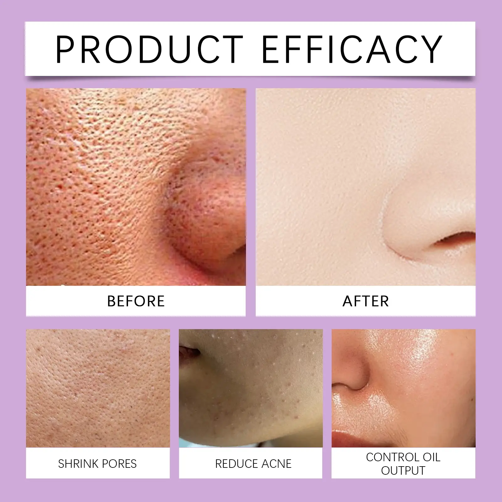 Moisturizing Essence Lotion for Daily Facial Care - West 9 moisturizing essence lotion nourish facial daily West Month 619 9058