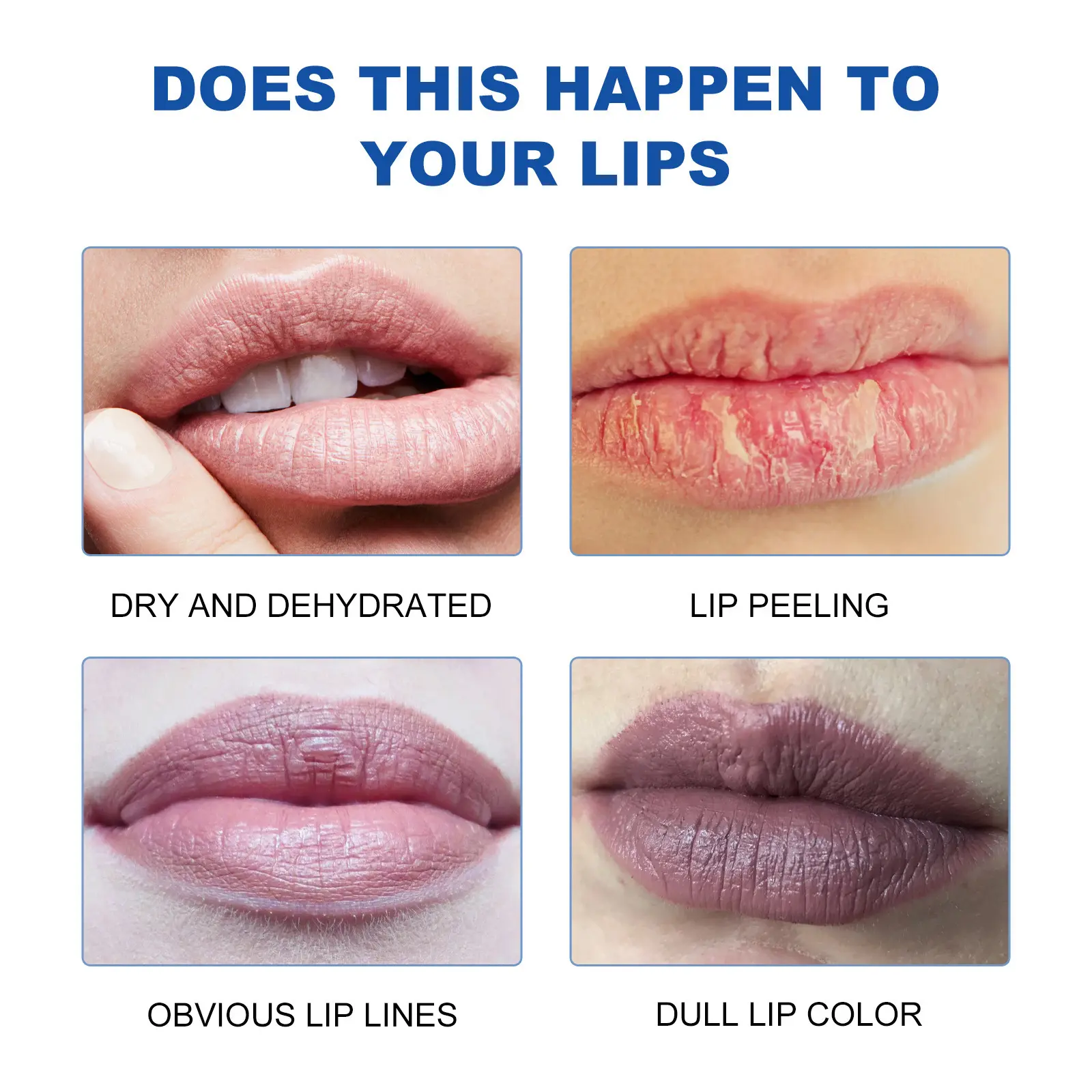 Moisturizing Lip Balm for Dry & Chapped Lips - West 6 moisturizing lip balm whiten lines moisturize West Month 361 5705